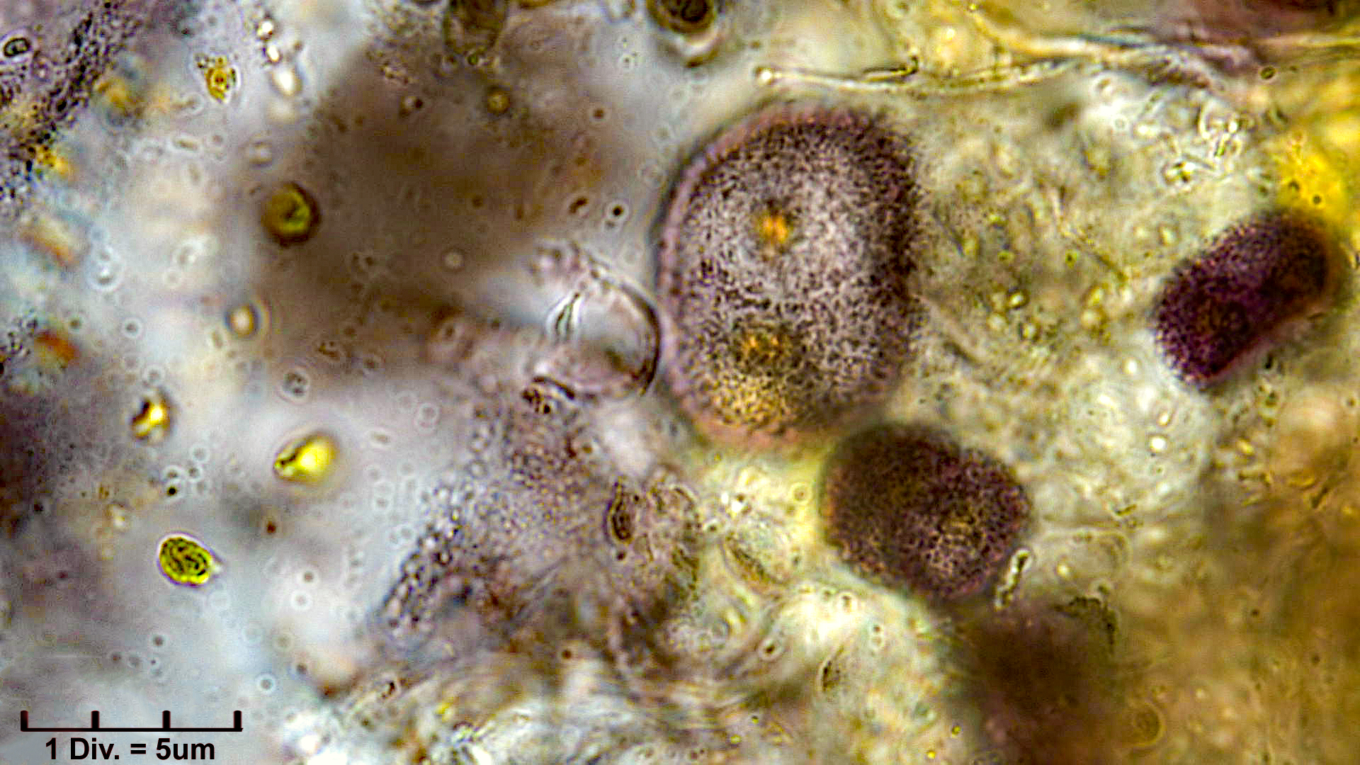 Cyanobacteria/Chroococcales/Chroococcaceae/Asterocapsa/sp/Asterocapsa7.jpg