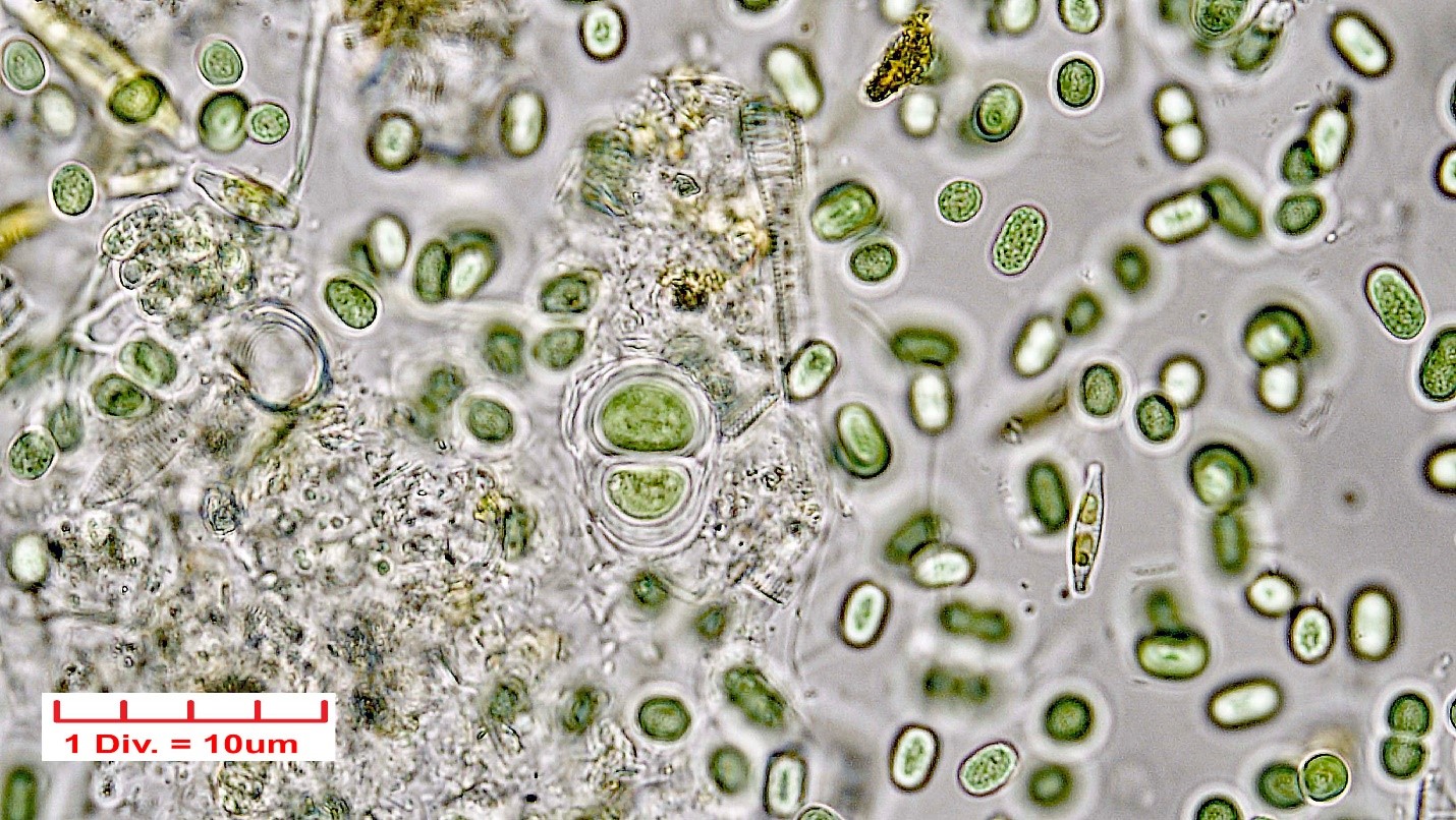 ././Cyanobacteria/Chroococcales/Chroococcaceae/Chroococcus/turgidus/chroococcus-turgidus-21.jpg