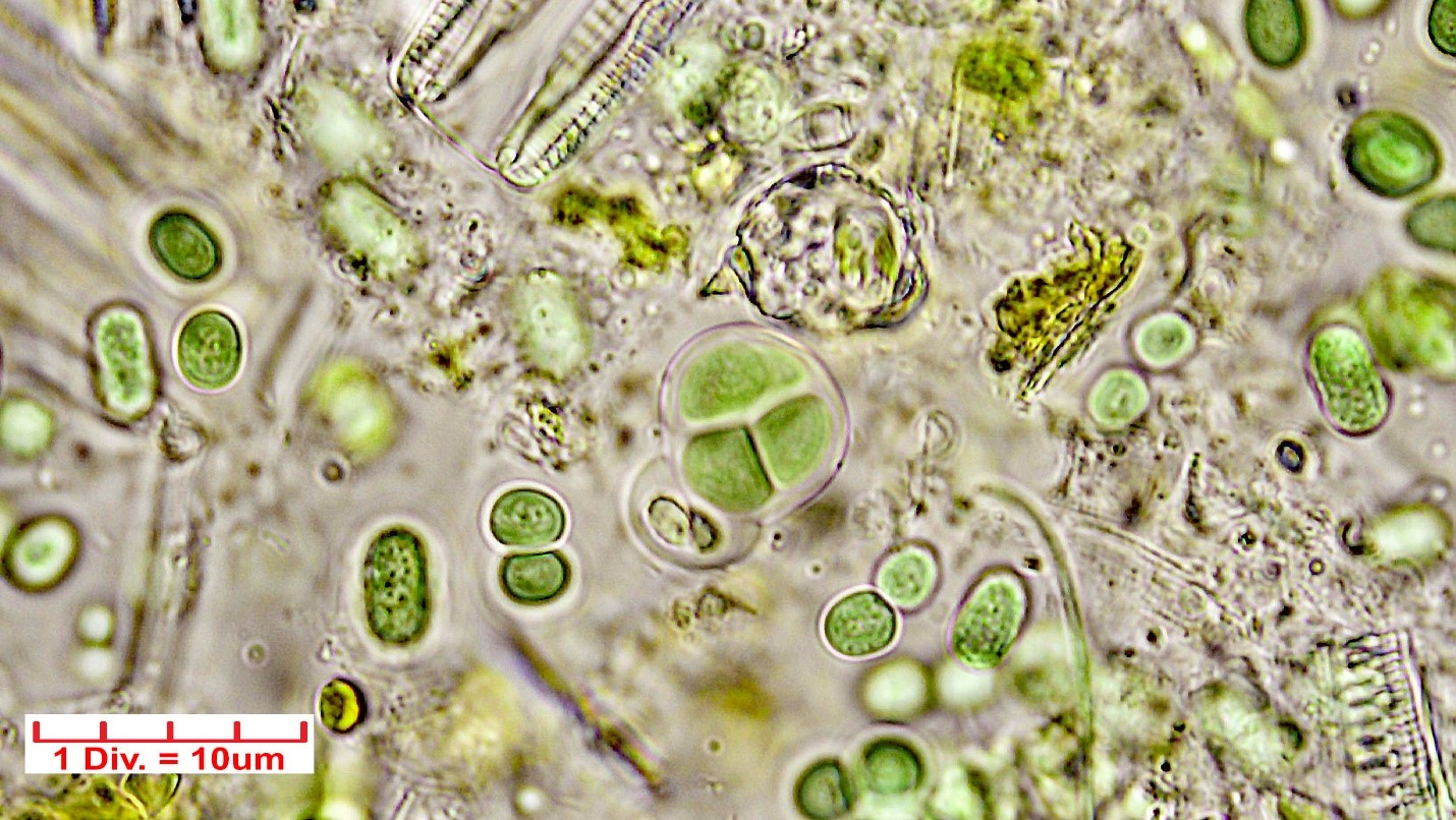 ././Cyanobacteria/Chroococcales/Chroococcaceae/Chroococcus/turgidus/chroococcus-turgidus-22.jpg