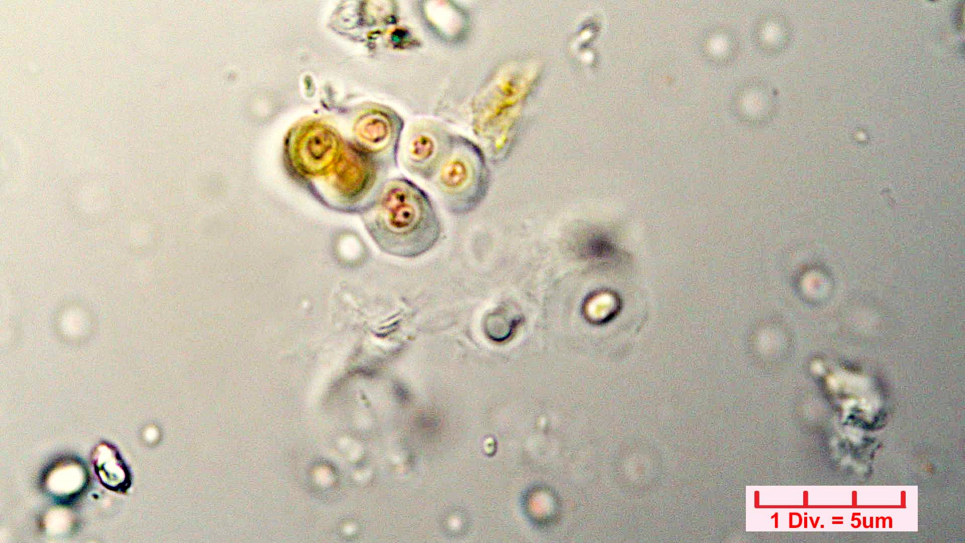 ././Cyanobacteria/Chroococcales/Chroococcaceae/Gloeocapsa/biformis/gloeocapsa-biformis-40.jpg