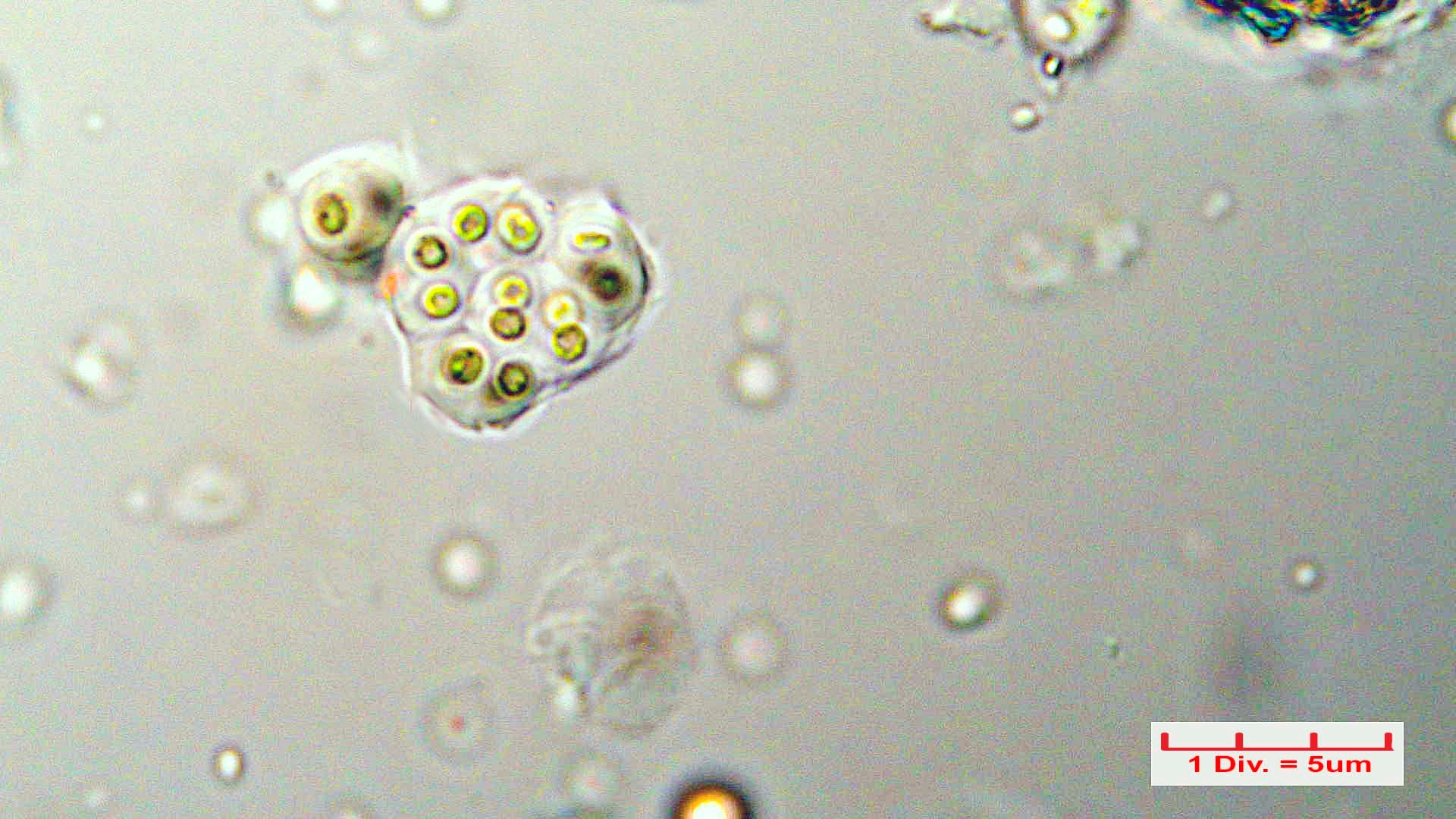 ././Cyanobacteria/Chroococcales/Chroococcaceae/Gloeocapsa/biformis/gloeocapsa-biformis-41.jpg