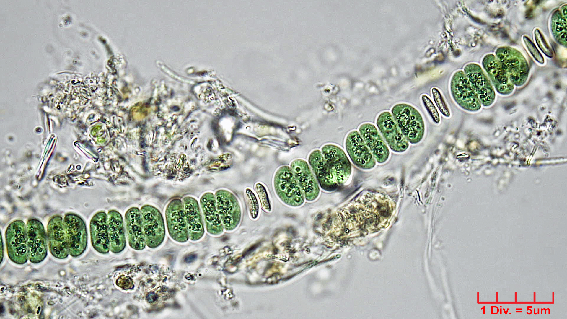 ./Cyanobacteria/Chroococcales/Cyanothricaceae/Johannesbaptistia/sp/johannesbaptistia-4.jpg