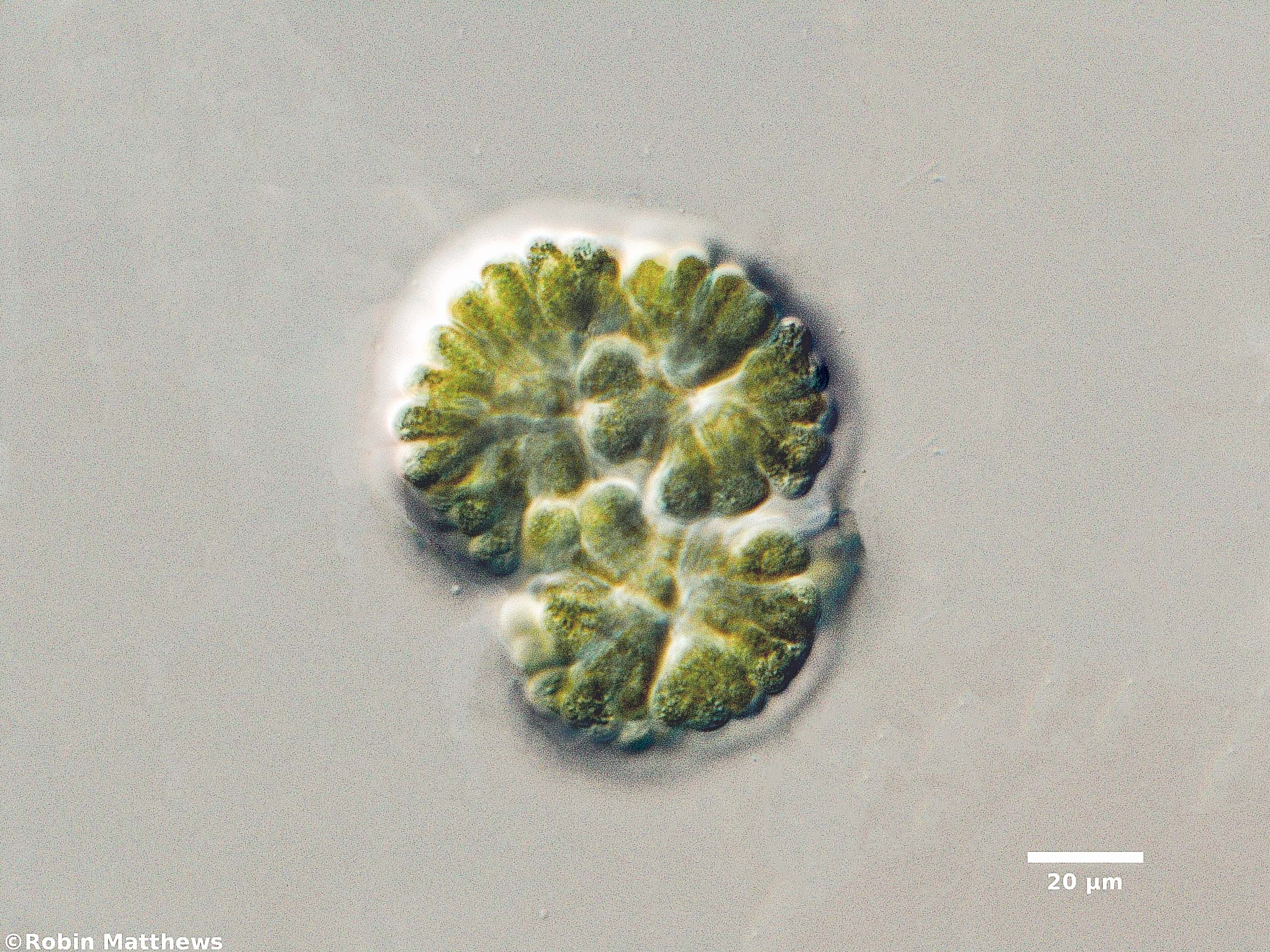 ././Cyanobacteria/Chroococcales/Gomphosphaeriaceae/Gomphosphaeria/aponina/gomphosphaeria-aponia-53.jpg