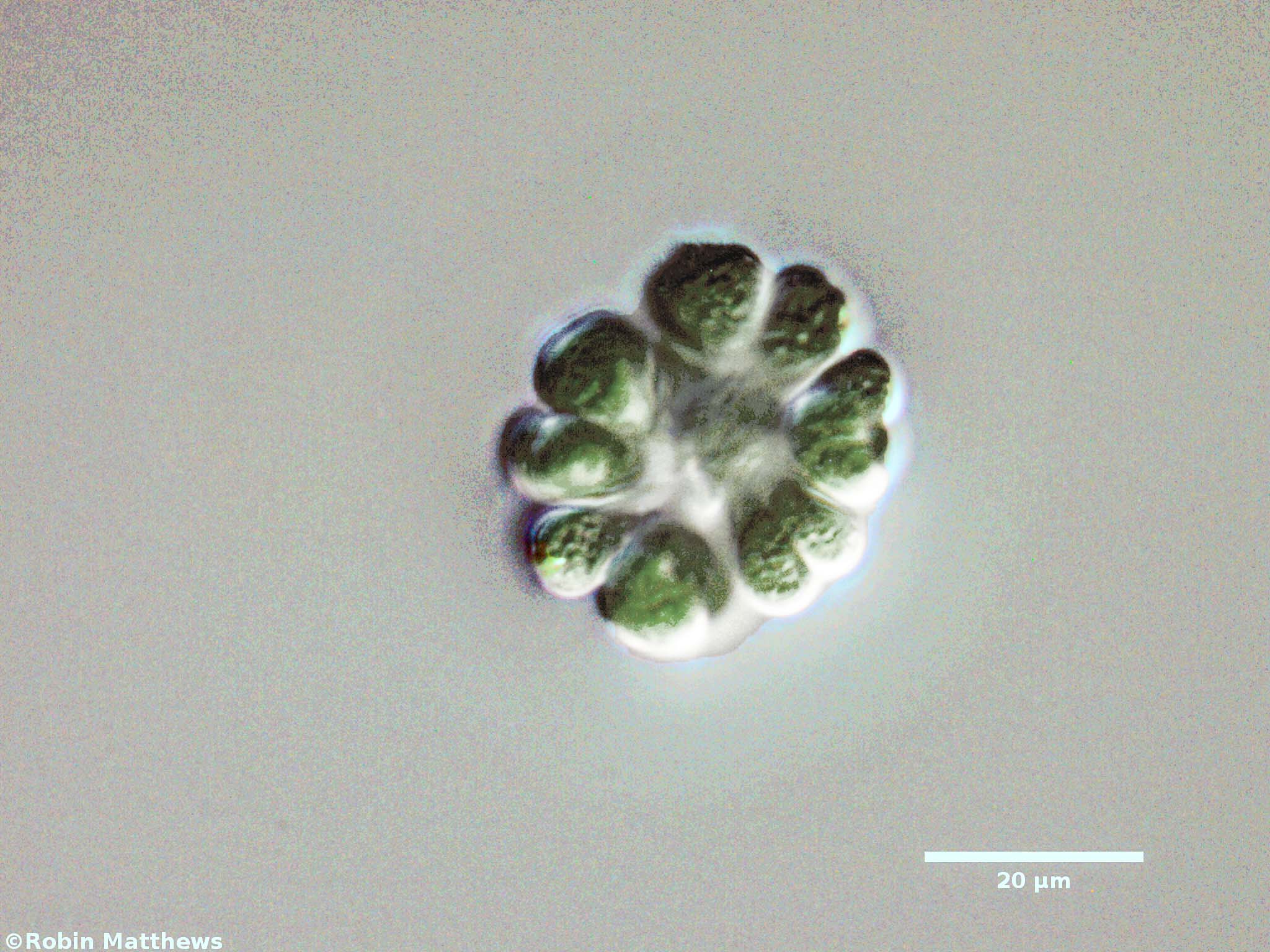 ././Cyanobacteria/Chroococcales/Gomphosphaeriaceae/Gomphosphaeria/aponina/gomphosphaeria-aponia-54.jpg