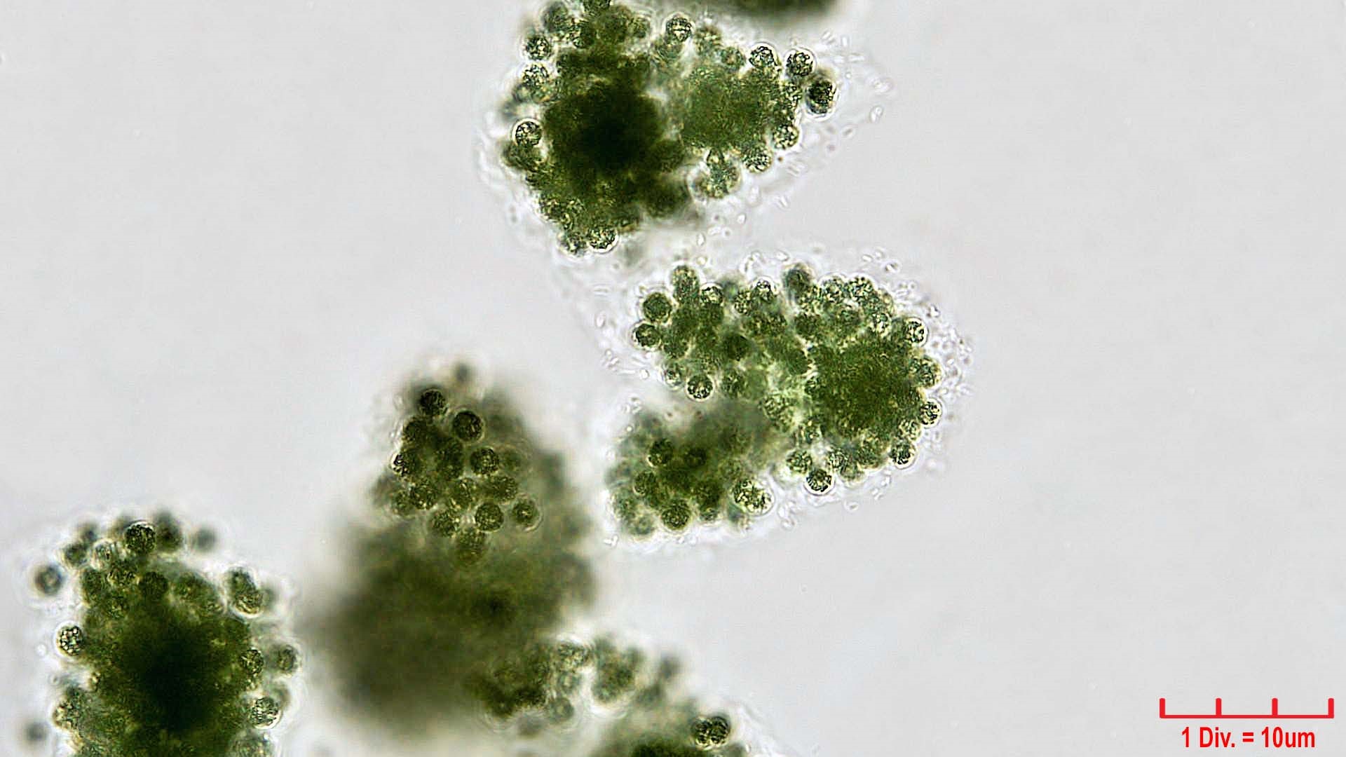 ././Cyanobacteria/Chroococcales/Microcystaceae/Microcystis/viridis/microcystis-viridis-66.jpg