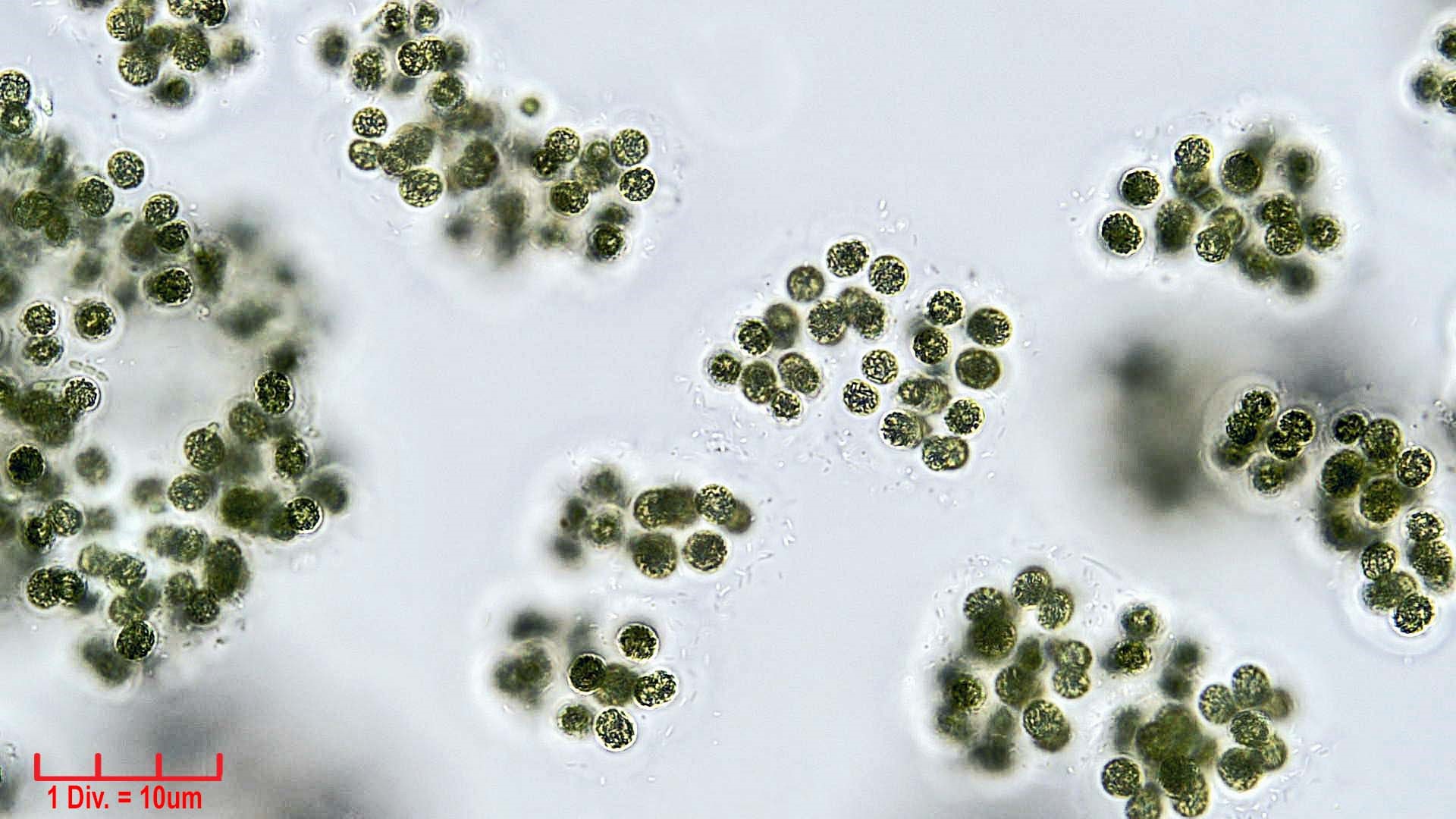 ././Cyanobacteria/Chroococcales/Microcystaceae/Microcystis/viridis/microcystis-viridis-67.jpg