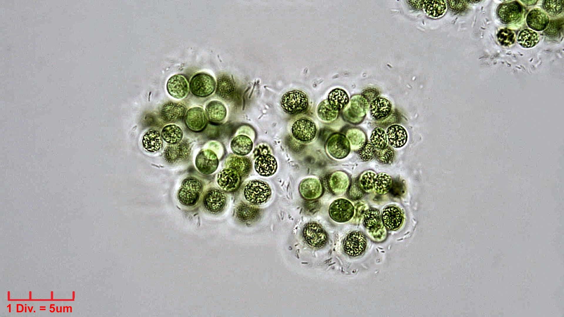 ./Cyanobacteria/Chroococcales/Microcystaceae/Microcystis/viridis/microcystis-viridis-68.jpg