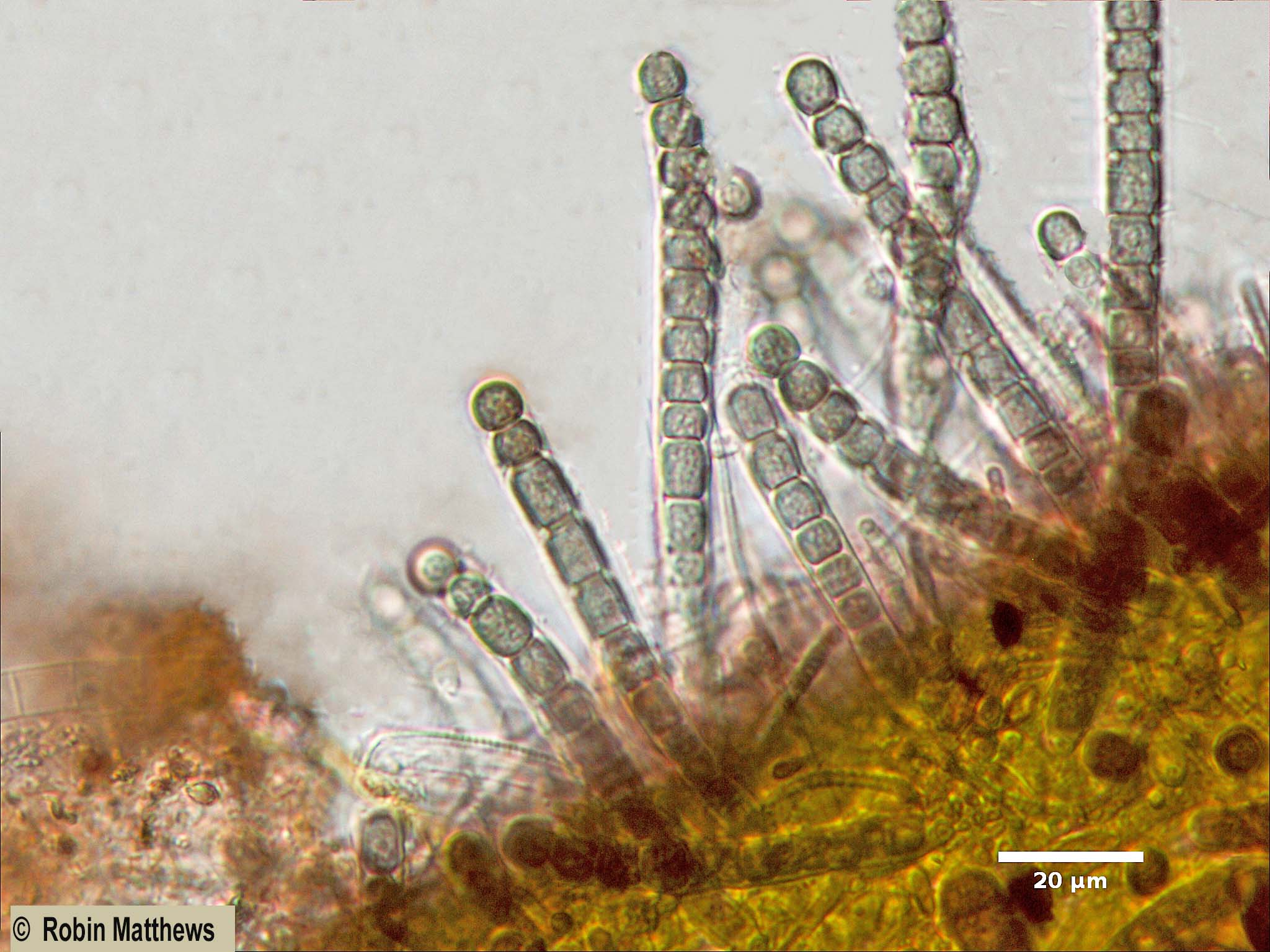 ././Cyanobacteria/Chroococcales/Stichosiphonaceae/Stichosiphon/willei/stichosiphon-willei-58.jpg