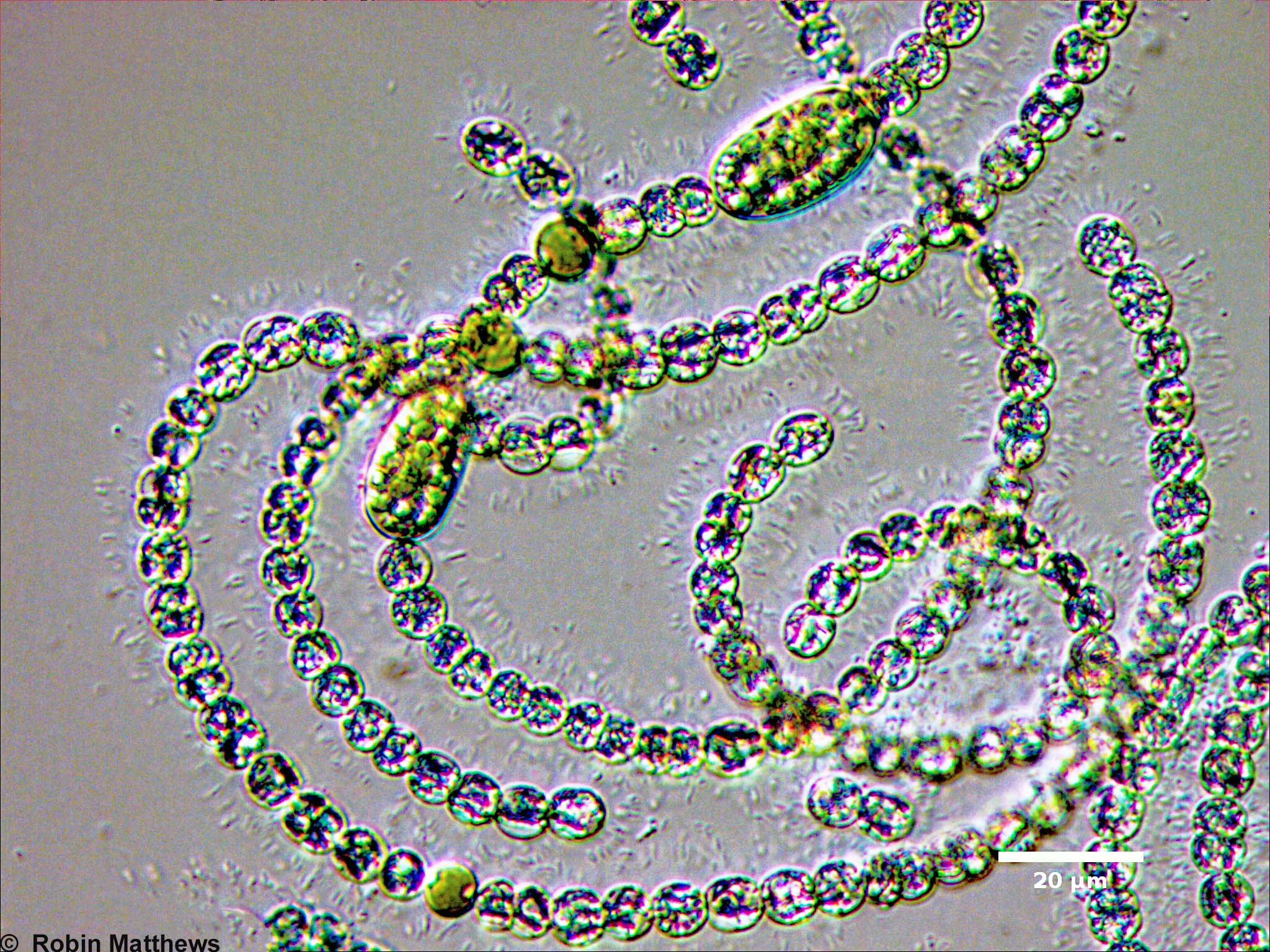 ./Cyanobacteria/Nostocales/Aphanizomenonaceae/Dolichospermum/circinale/dolichospermum-555.jpg