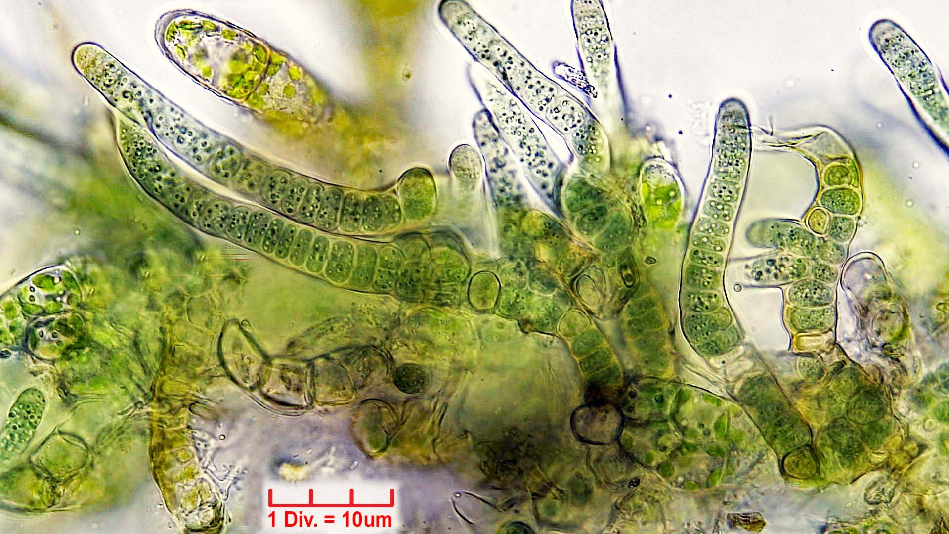 ././Cyanobacteria/Nostocales/Hapalosiphonaceae/Fischerella/muscicola/fischerella-muscicola-510.jpg