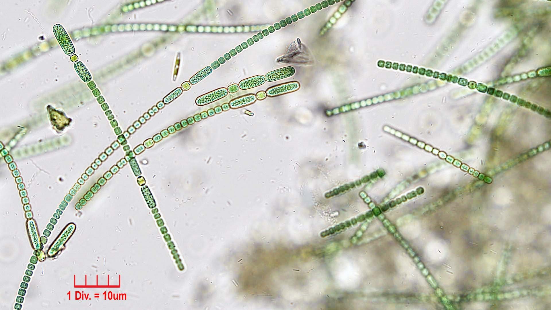 ././Cyanobacteria/Nostocales/Nostocaceae/Anabaena/oscillarioides/anabaena-oscillarioides-623.jpg