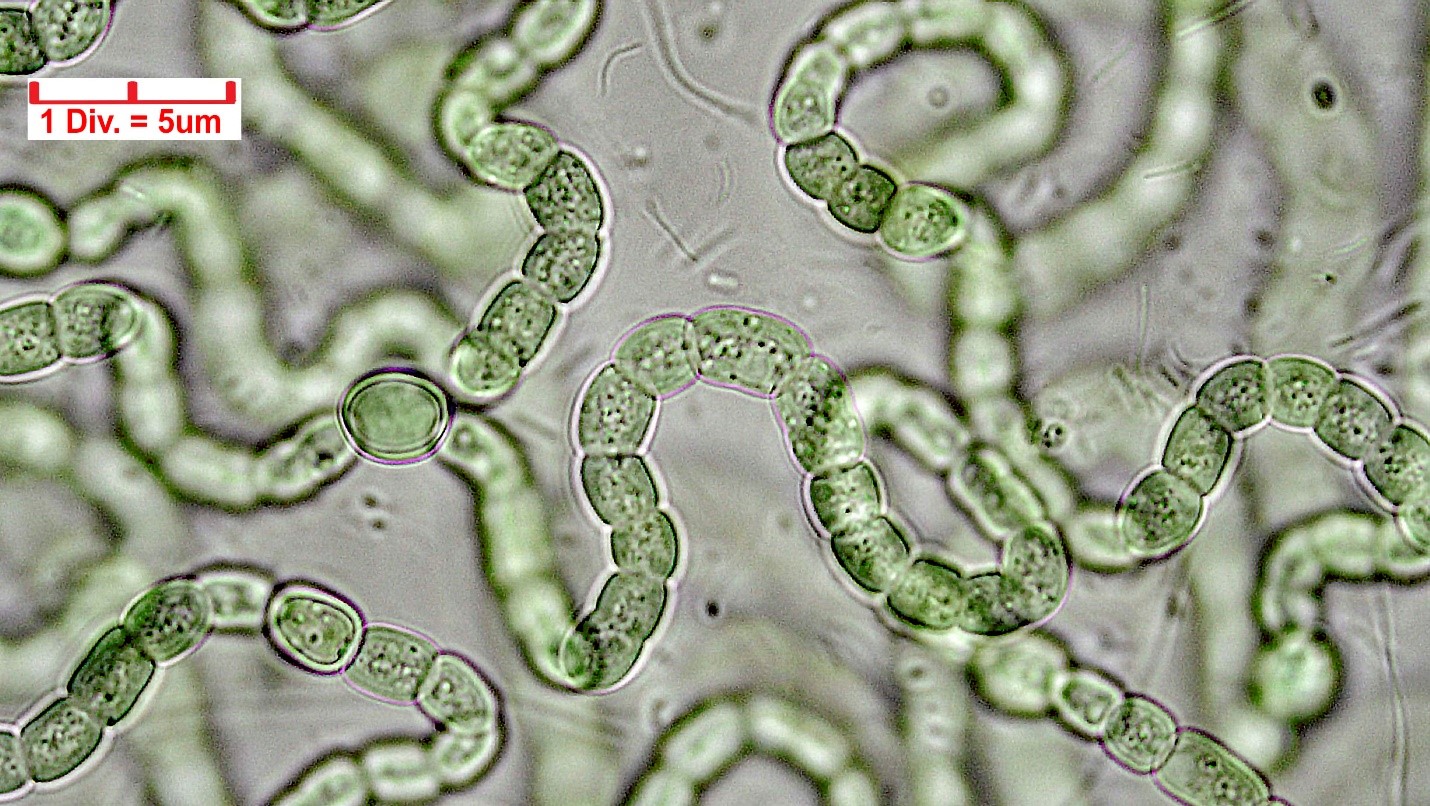 ./Cyanobacteria/Nostocales/Nostocaceae/Nostoc/carneum/nostoc-carneum-595.jpg