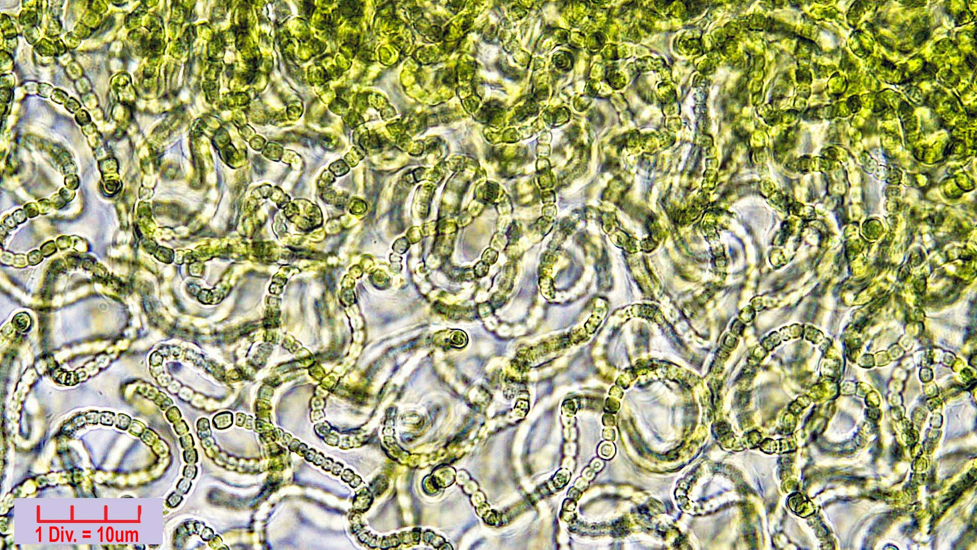 ././Cyanobacteria/Nostocales/Nostocaceae/Nostoc/verrucosum/nostoc-verrucosum-609.jpg