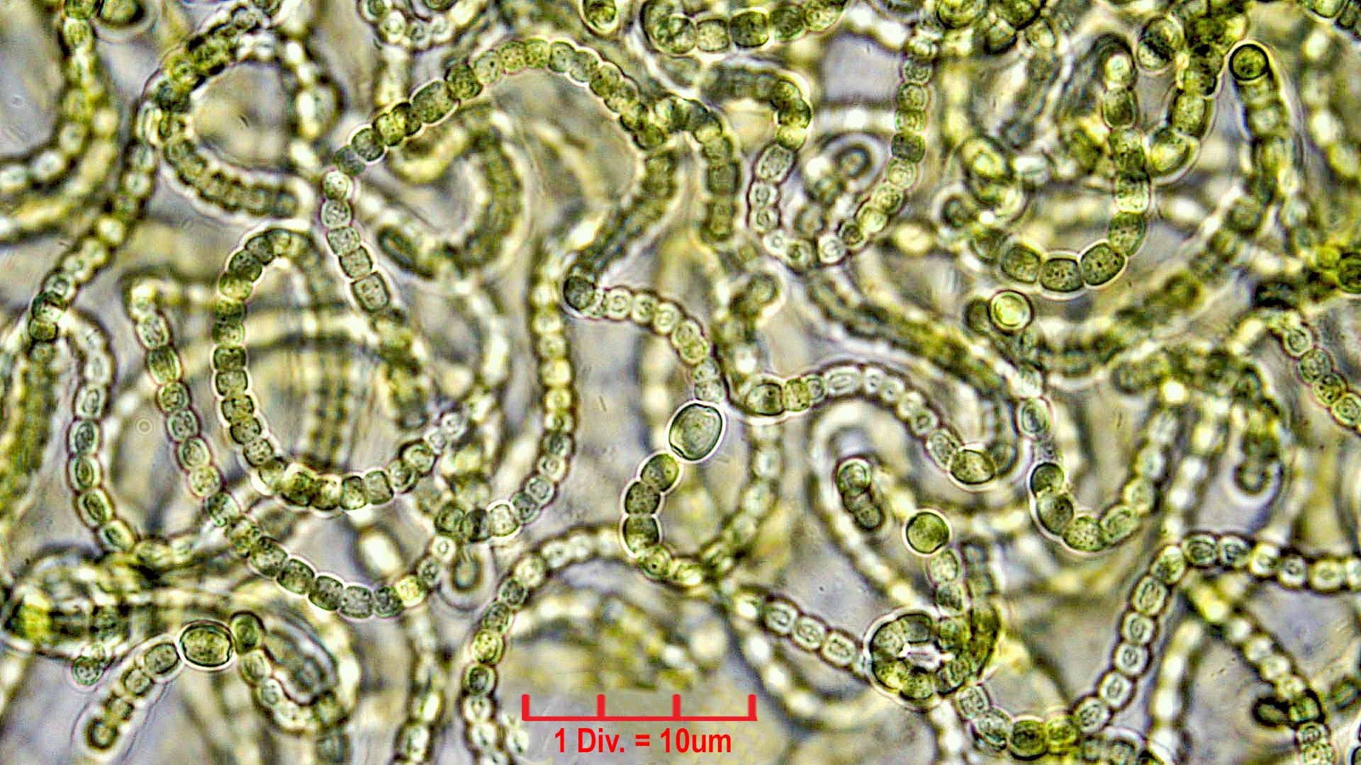 ./Cyanobacteria/Nostocales/Nostocaceae/Nostoc/verrucosum/nostoc-verrucosum-610.jpg