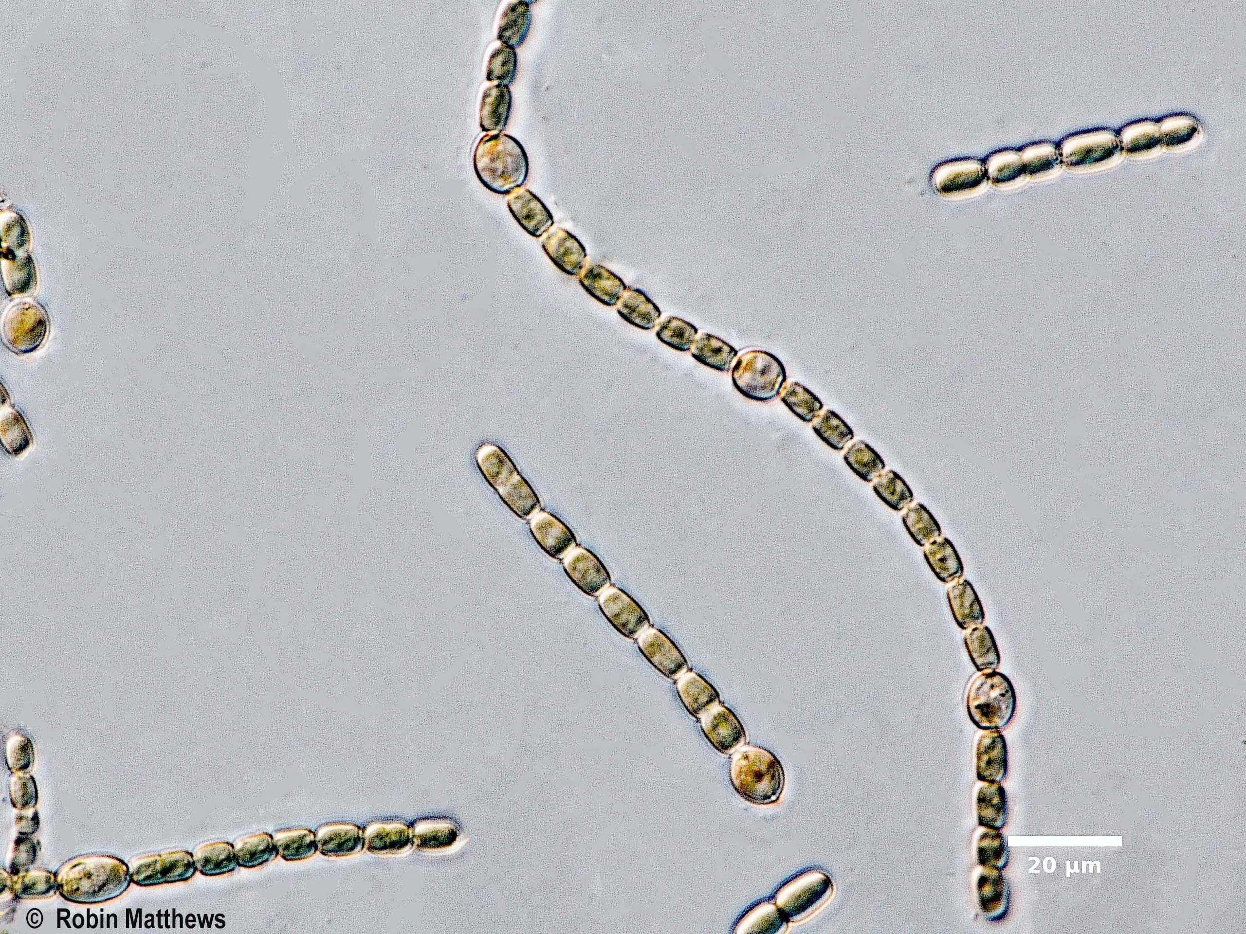 ././Cyanobacteria/Nostocales/Nostocaceae/Trichormus/azollae/trichormus-azollae-631.jpg