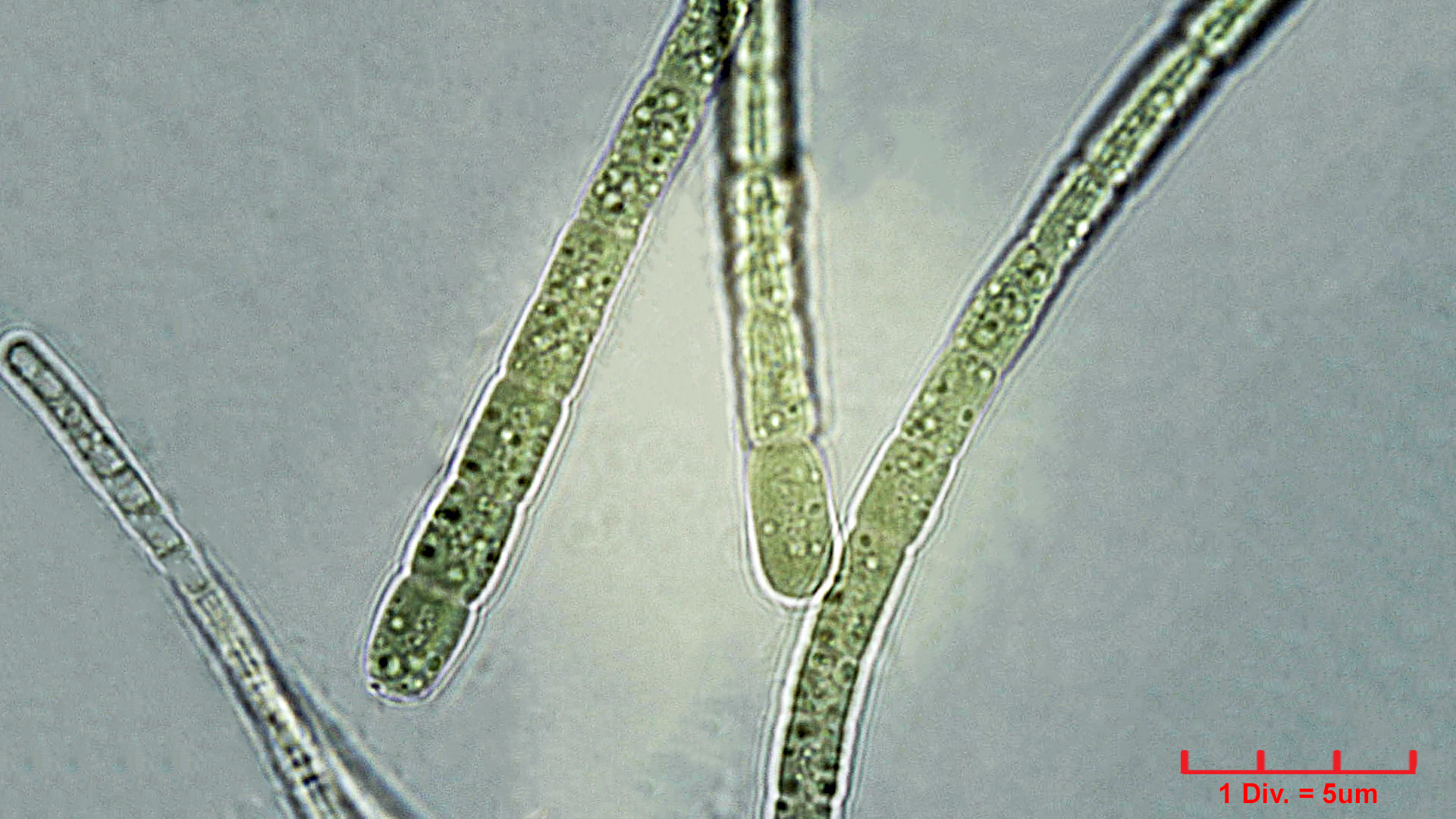 ./Cyanobacteria/Nostocales/Rivulariaceae/Dichothrix/gypsophila/dichothrix-gypsophila-461.jpg