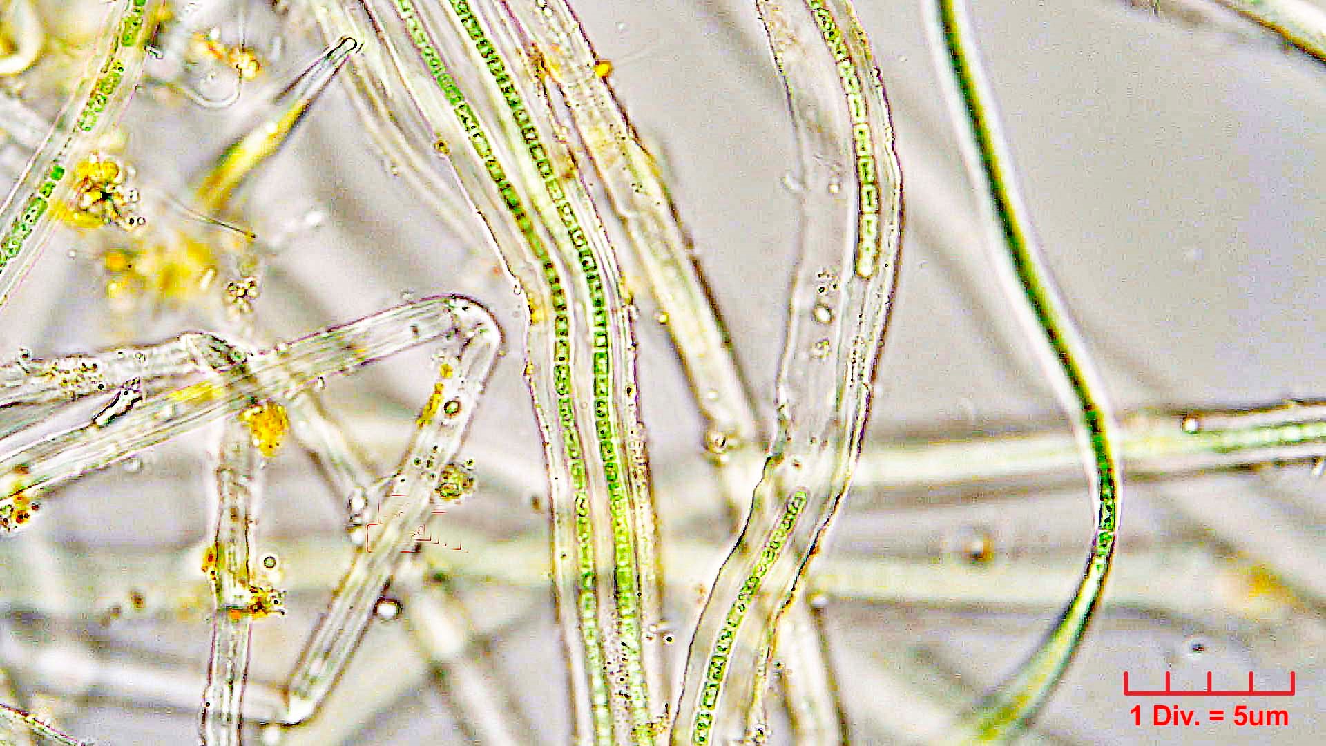 ././Cyanobacteria/Nostocales/Rivulariaceae/Rivularia/minutula/rivularia-minutula-474.jpg