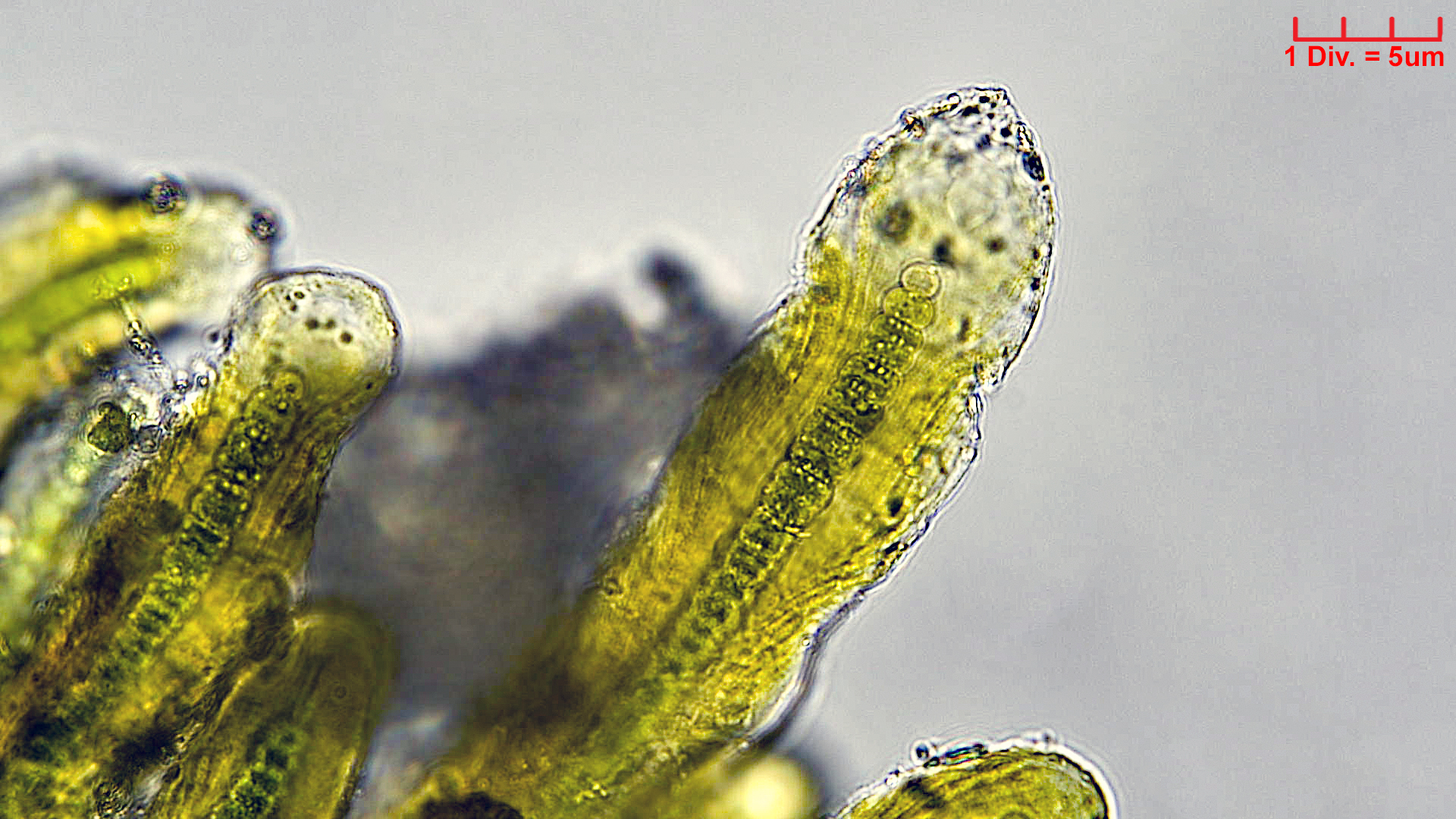 ././Cyanobacteria/Nostocales/Scytonemataceae/Petalonema/densum/petalonema-densum-3.jpg