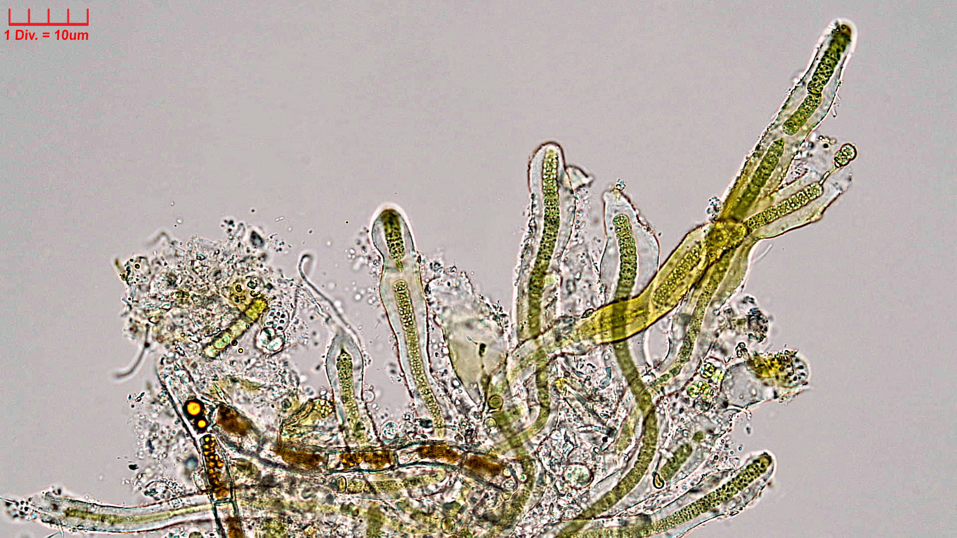 ./Cyanobacteria/Nostocales/Scytonemataceae/Petalonema/incrustans/petalonema-incrustans-414.jpg