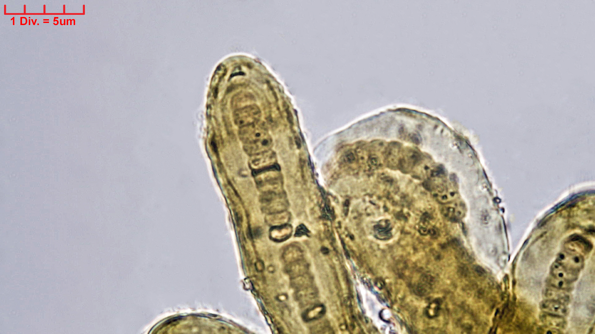 ././Cyanobacteria/Nostocales/Scytonemataceae/Petalonema/incrustans/petalonema-incrustans-419.jpg