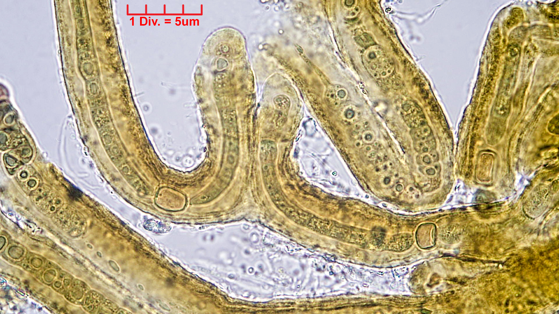 ././Cyanobacteria/Nostocales/Scytonemataceae/Petalonema/incrustans/petalonema-incrustans-421.jpg