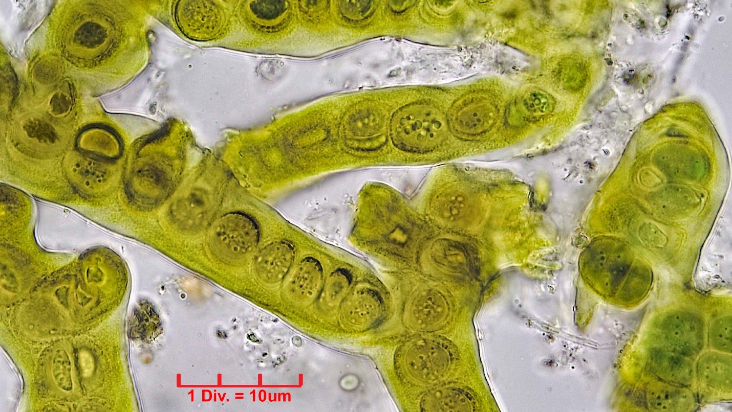 ././Cyanobacteria/Nostocales/Stigonemataceae/Stigonema/informe/stigonema-informe-521.jpg