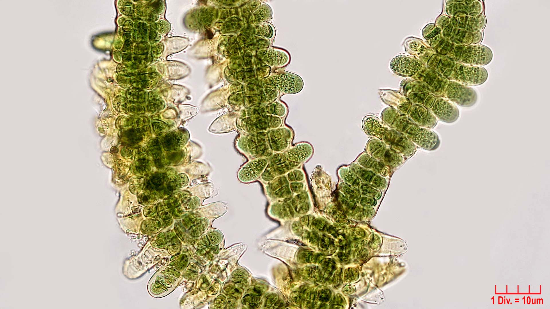 ./Cyanobacteria/Nostocales/Stigonemataceae/Stigonema/mamillosum/stigonema-mamillosum-540.jpg