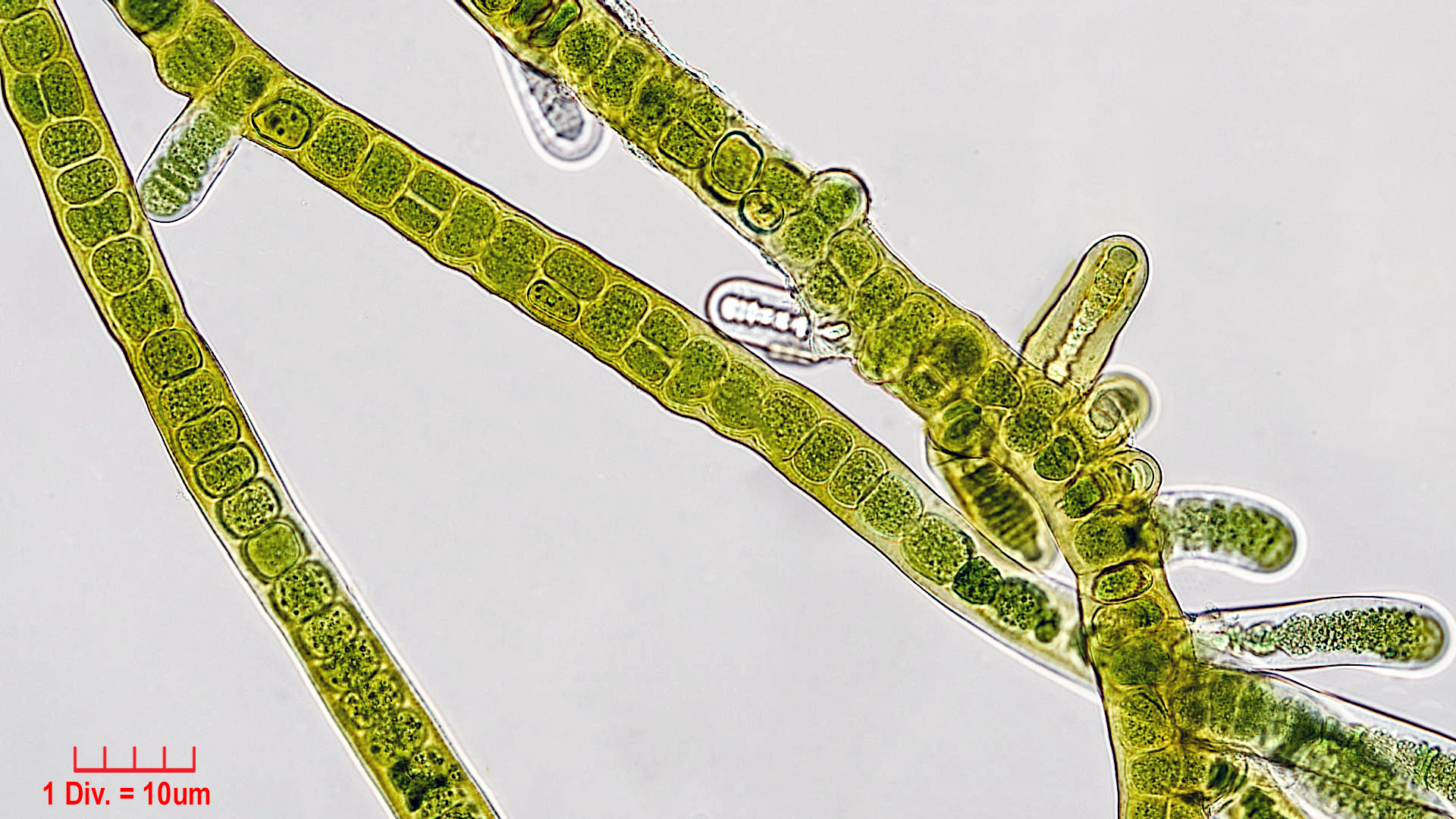 ././Cyanobacteria/Nostocales/Stigonemataceae/Stigonema/ocellatum/stigonema-ocellatum-1001.jpg