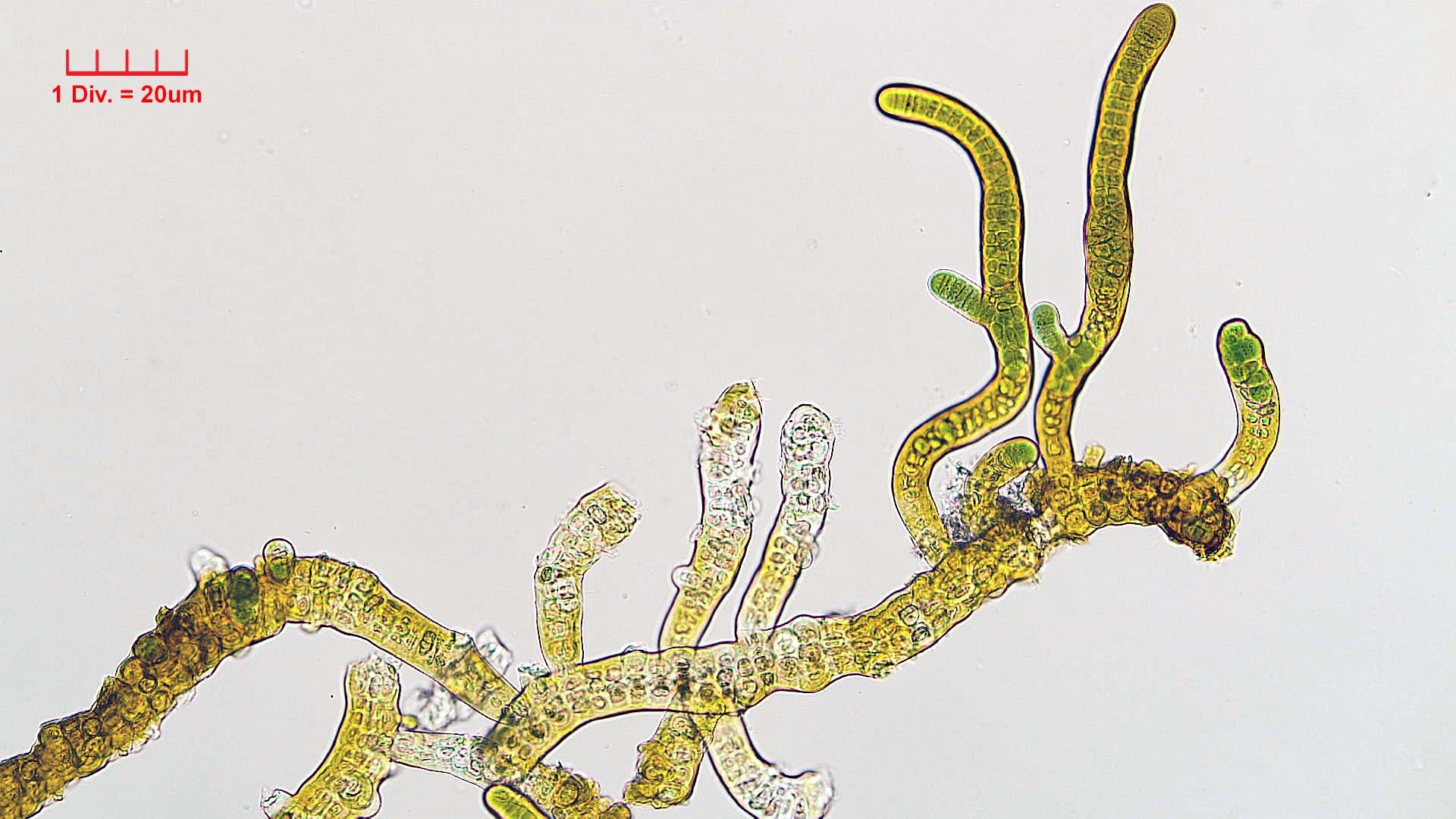./Cyanobacteria/Nostocales/Stigonemataceae/Stigonema/turfaceum/stigonema-turfaceum-523.jpg