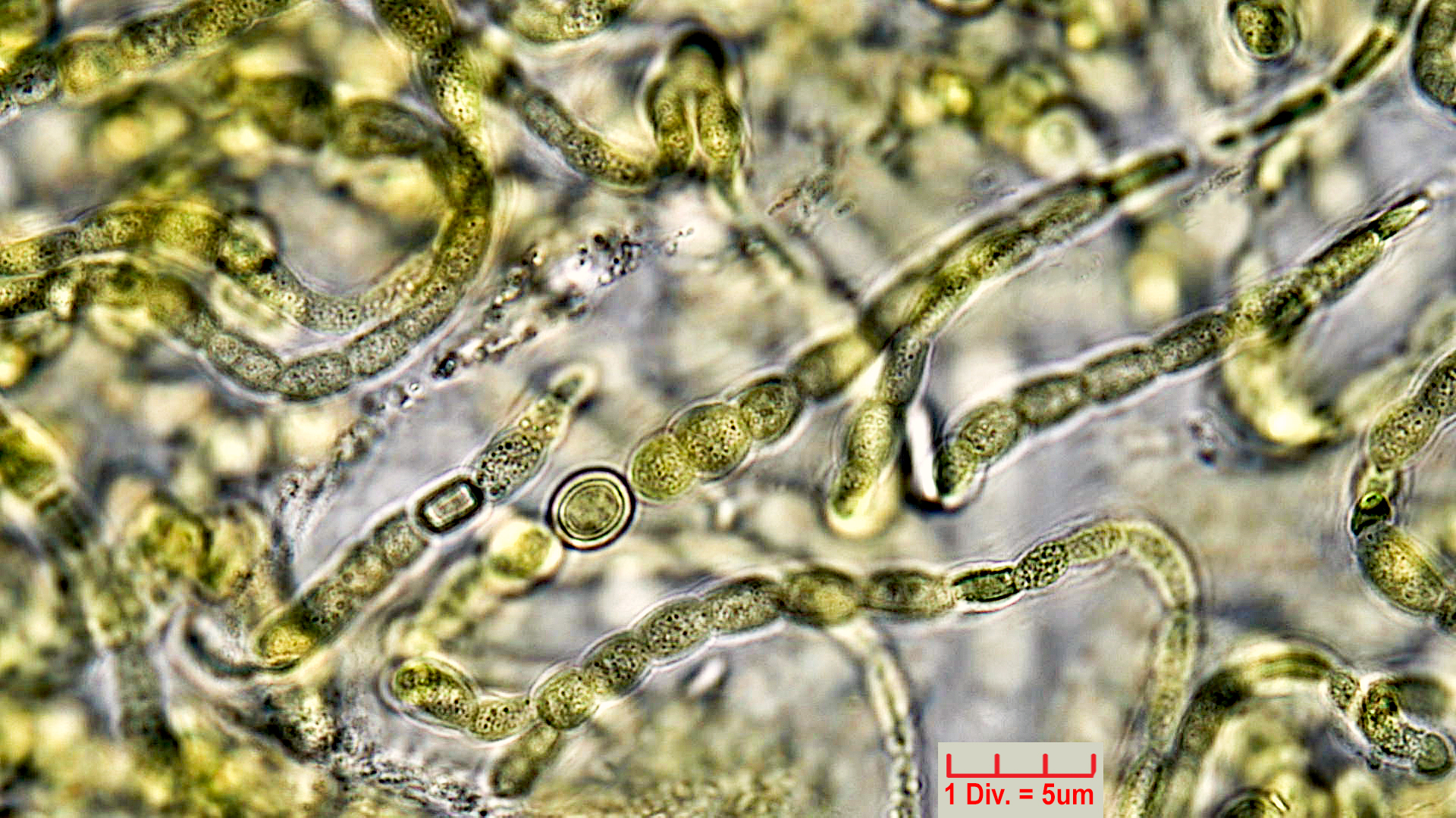 ././Cyanobacteria/Nostocales/Symphyonemataceae/Brachytrichia/sp/brachytrichia-6.jpg