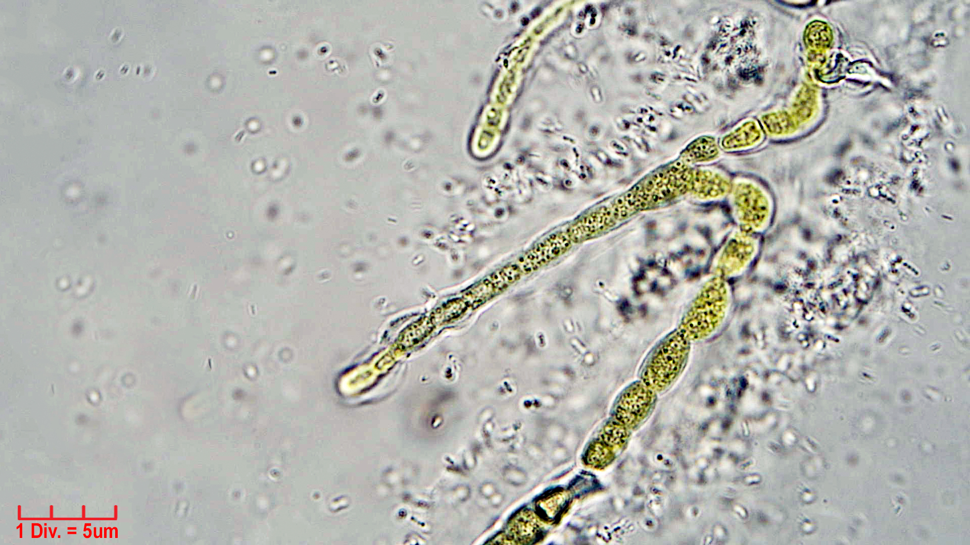 ././Cyanobacteria/Nostocales/Symphyonemataceae/Brachytrichia/sp/brachytrichia-8.jpg