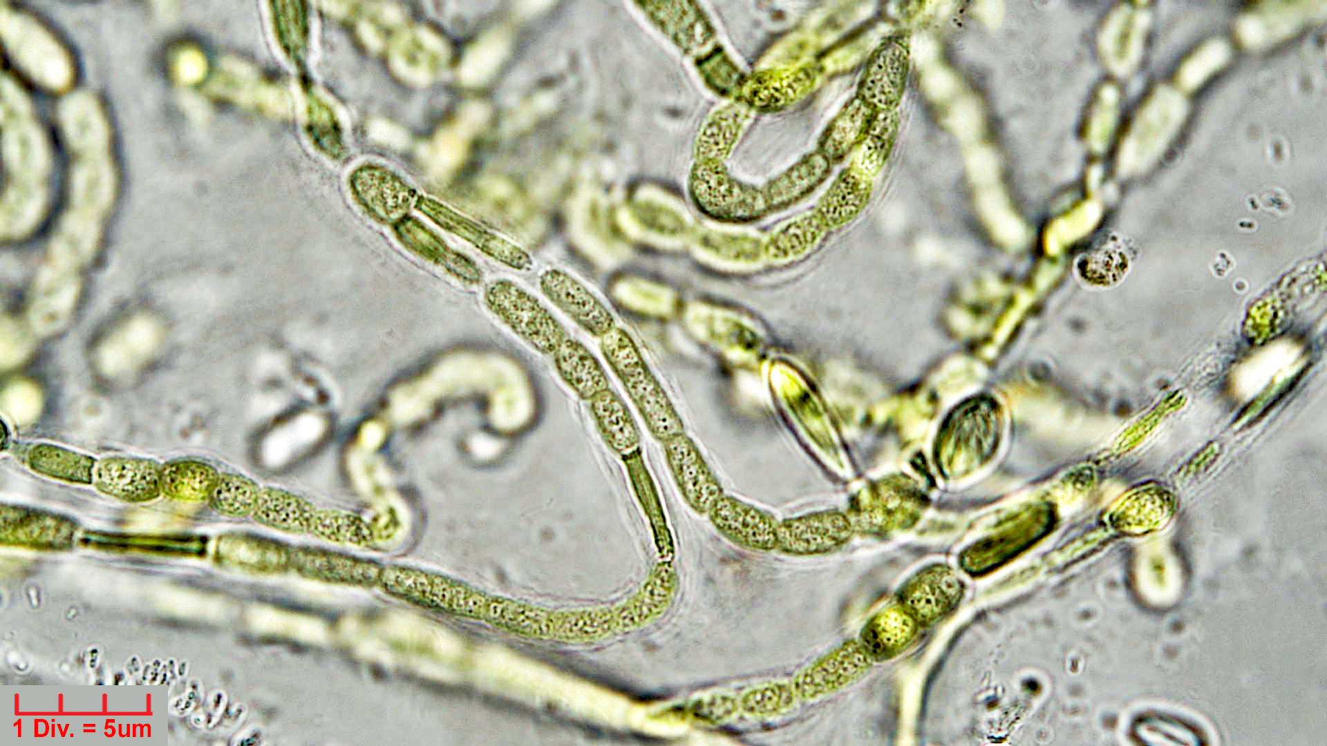 ././Cyanobacteria/Nostocales/Symphyonemataceae/Brachytrichia/sp/brachytrichia-9.jpg