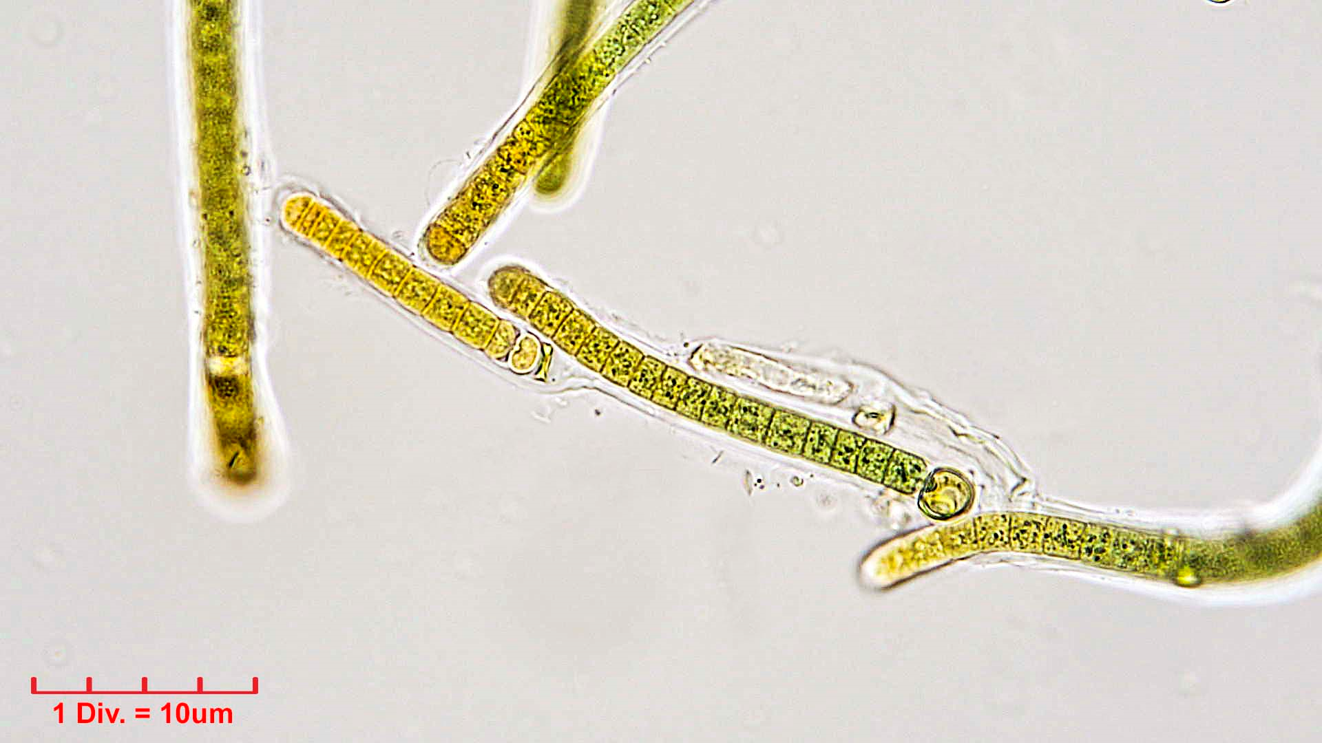 ./Cyanobacteria/Nostocales/Tolypothrichaceae/Tolypothrix/calcarata/tolypothrix-calcarata-321.png