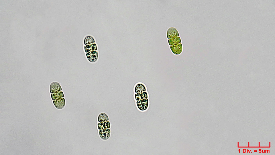 ./Cyanobacteria/Oscillatoriales/Borziaceae/Borzia/triocularis/borzia-triocularis-239.png