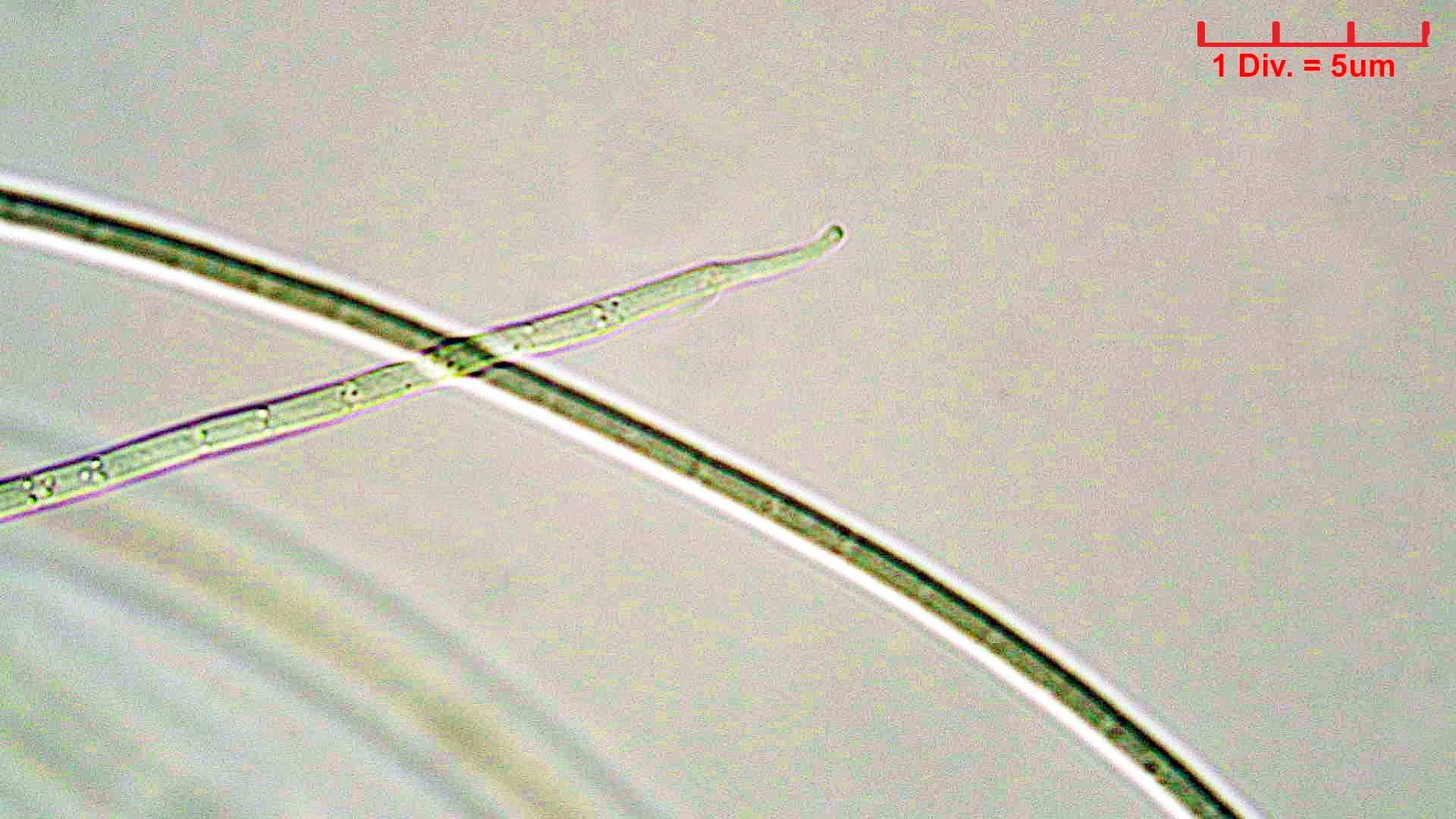 ./Cyanobacteria/Oscillatoriales/Coleofasciculaceae/Geitlerinema/splendidum/geitlerinema-splendidum-291.jpg