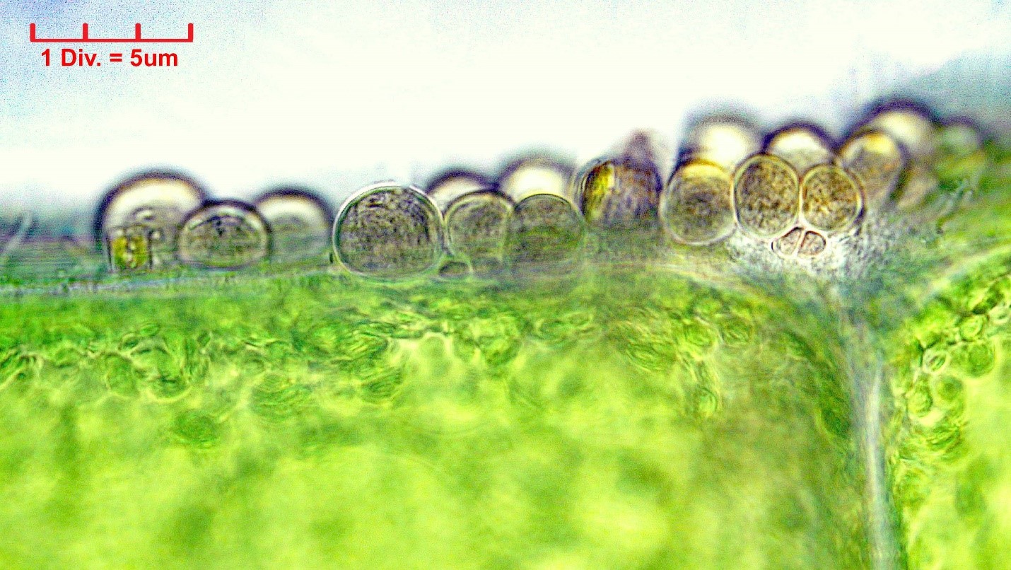 ././Cyanobacteria/Pleurocapsales/Dermocarpellaceae/Cyanocystis/hemisphaerica/cyanocystis-hemisphaerica-157.jpg