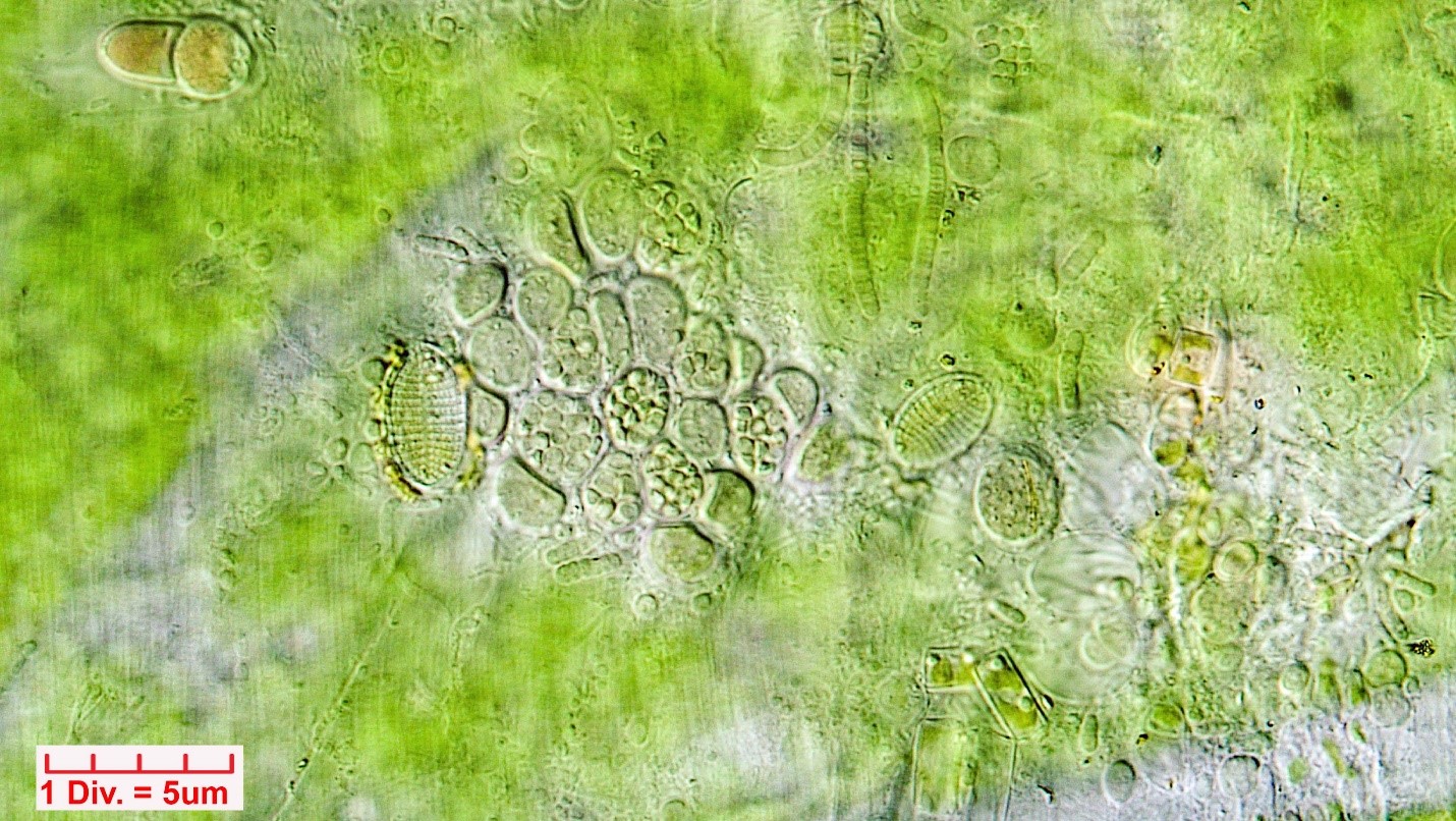 ././Cyanobacteria/Pleurocapsales/Dermocarpellaceae/Cyanocystis/violaceae/cyanocystis-violaceae-155.jpg