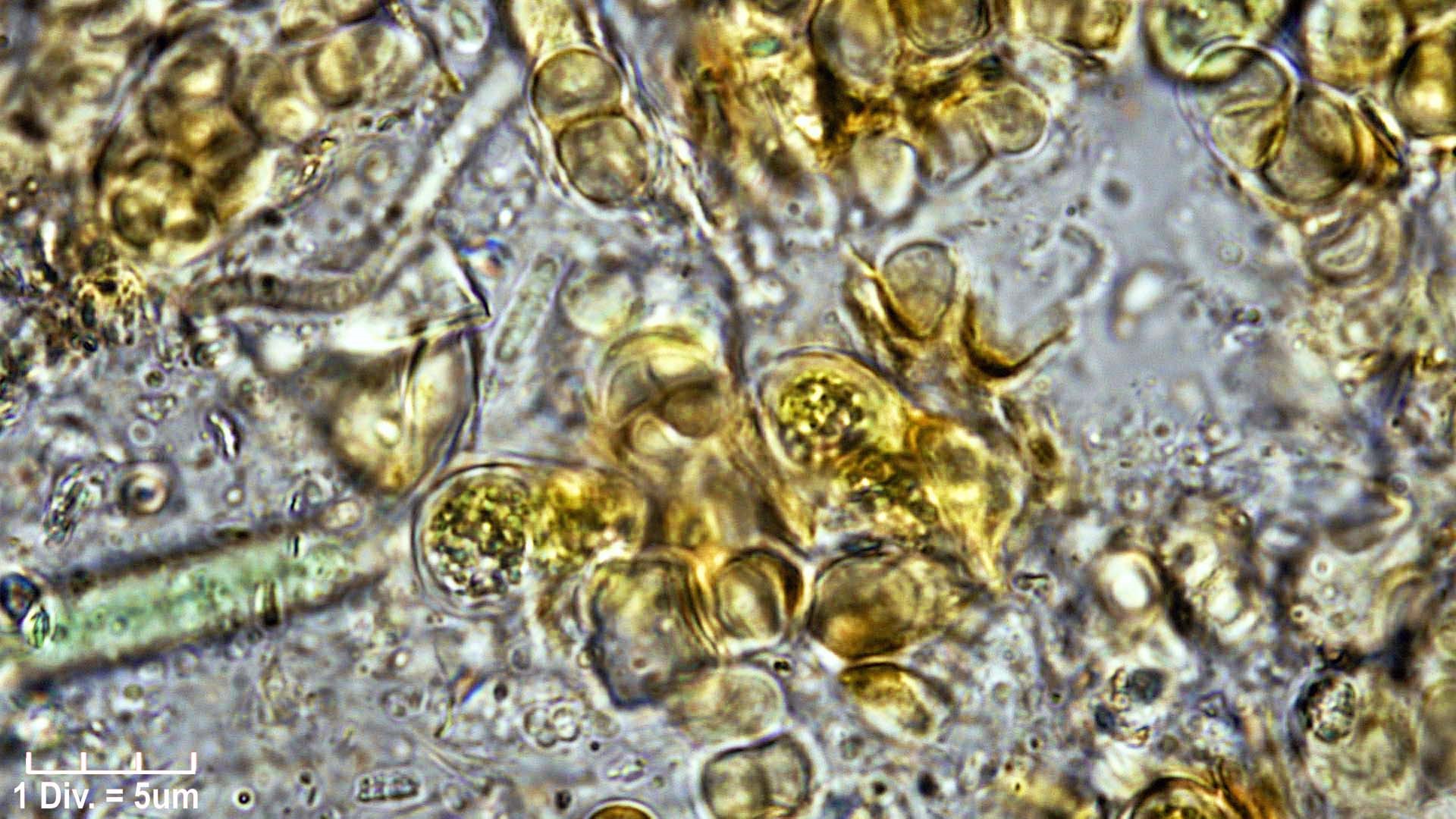 ././Cyanobacteria/Pleurocapsales/Hyellaceae/Pleurocapsa/fuliginosa/pleurocapsa-fuliginosa-166.jpg