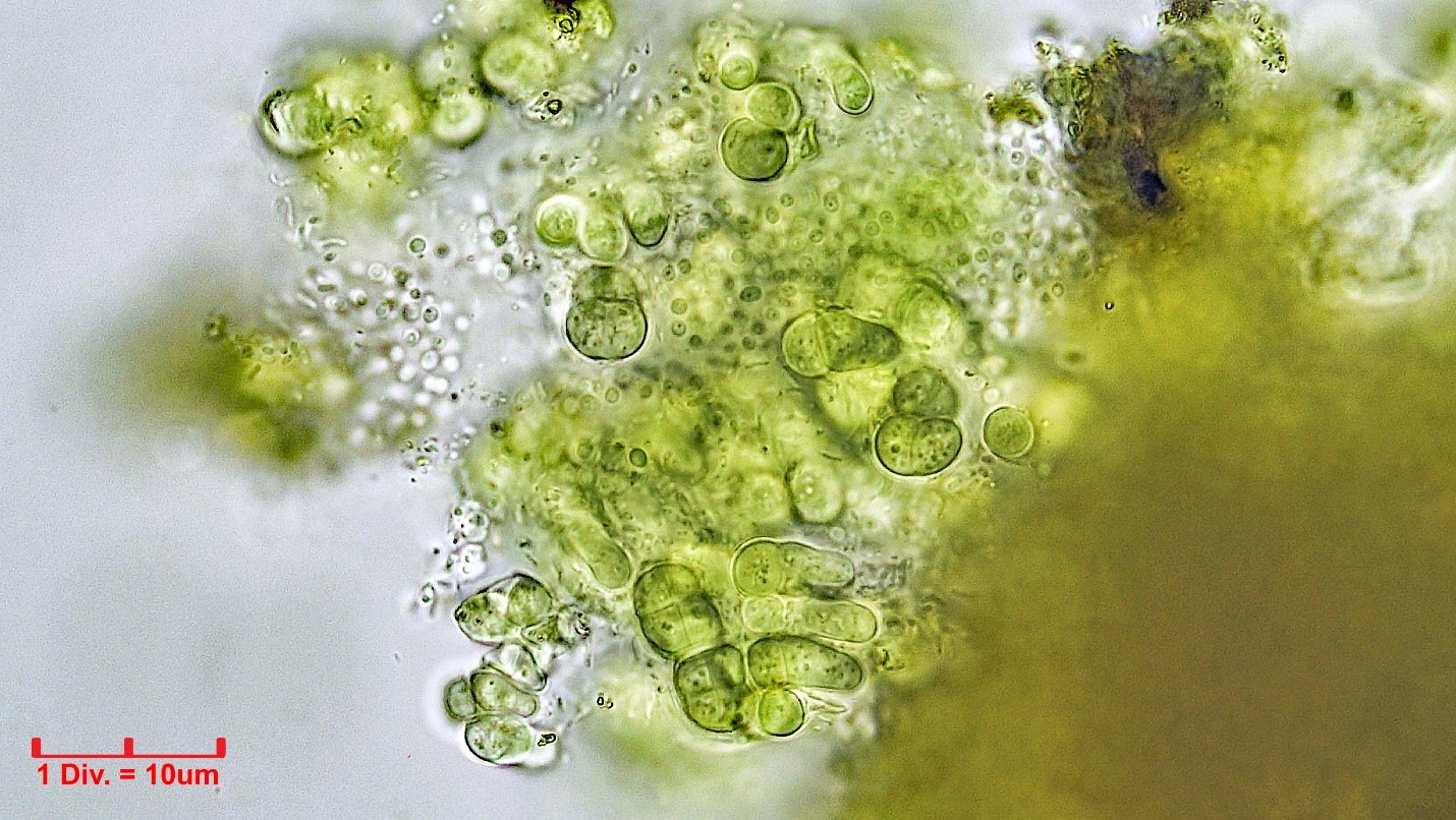 ././Cyanobacteria/Pleurocapsales/Hyellaceae/Pleurocapsa/sp/pleurocapsa-159.jpg
