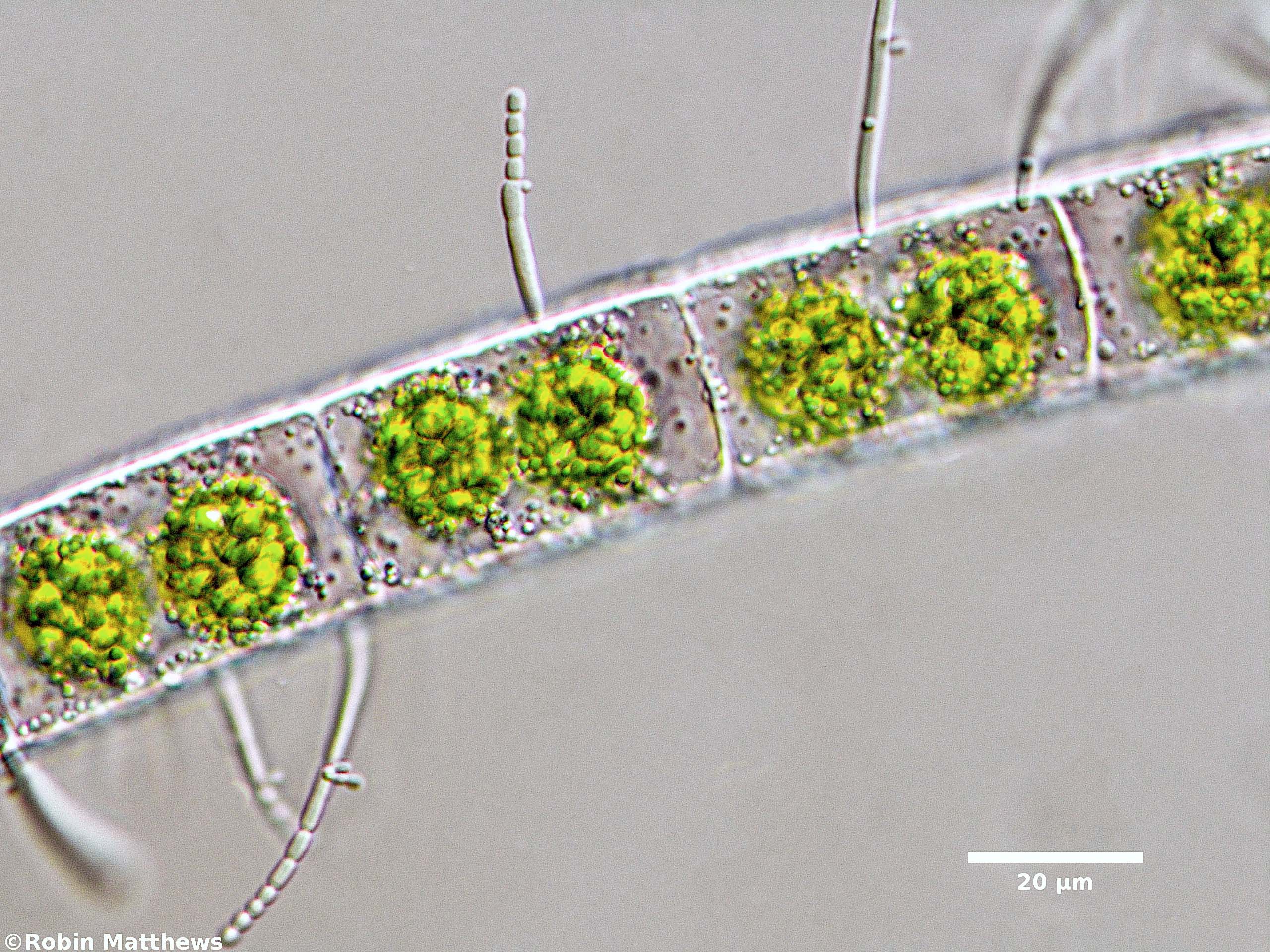 ./Cyanobacteria/Synechococcales/Chamaesiphonaceae/Cyanophanon/sp/cyanophanon-86.jpg