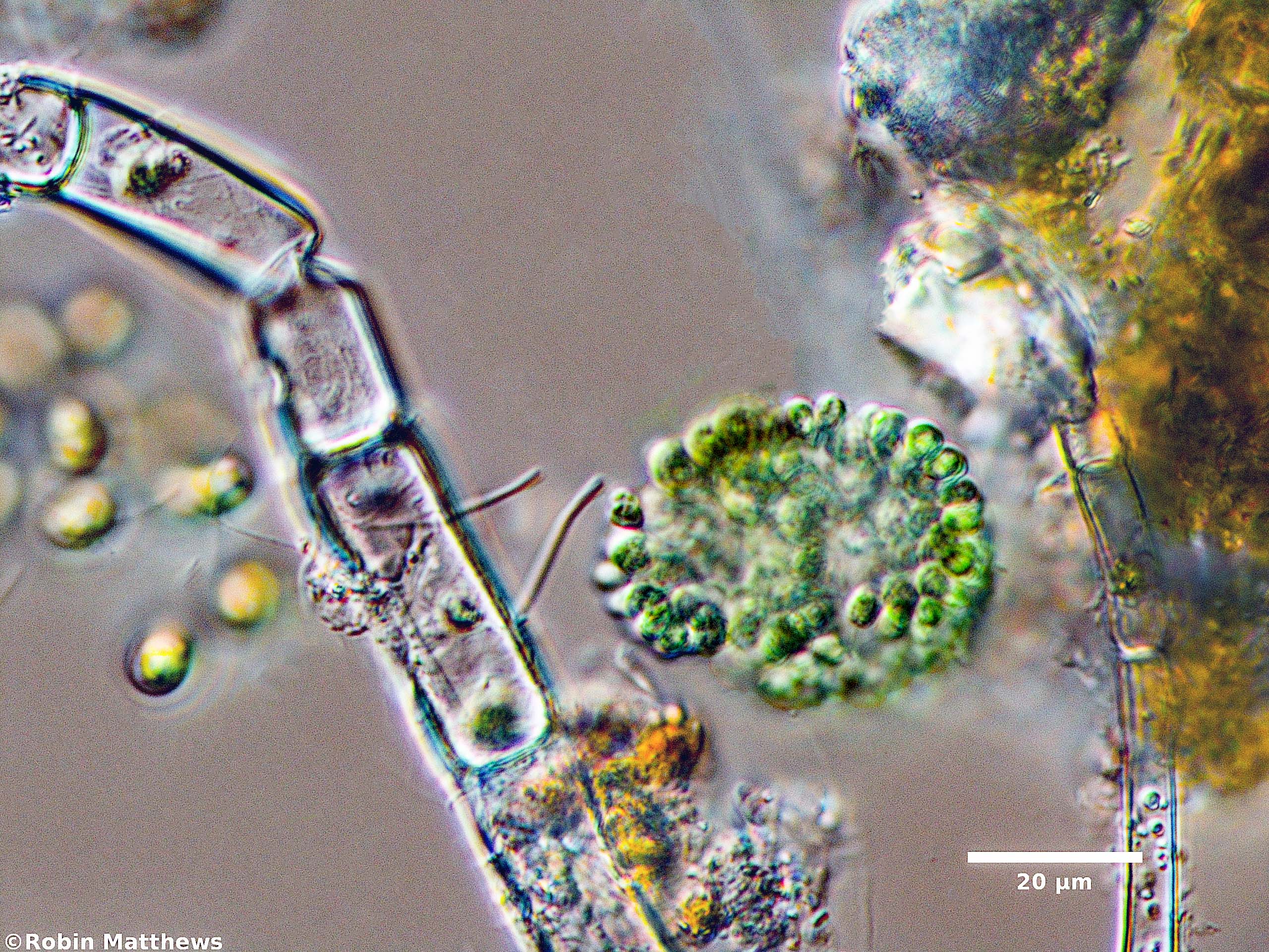 ././Cyanobacteria/Synechococcales/Coleosphaeriaceae/Coelomoron/sp/coelomoron-101.jpg