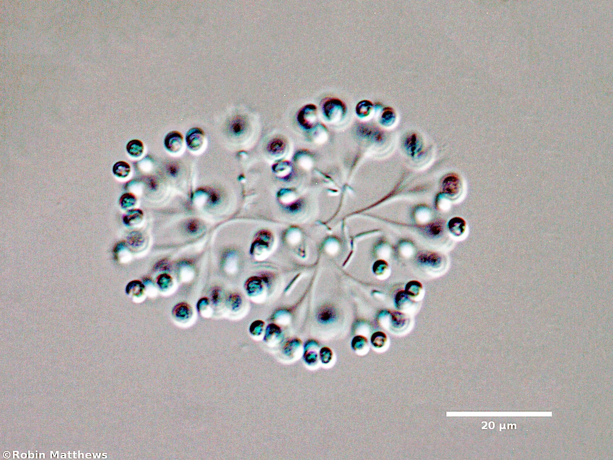 ././Cyanobacteria/Synechococcales/Coleosphaeriaceae/Snowella/litoralis/snowella-litoralis-103.jpg