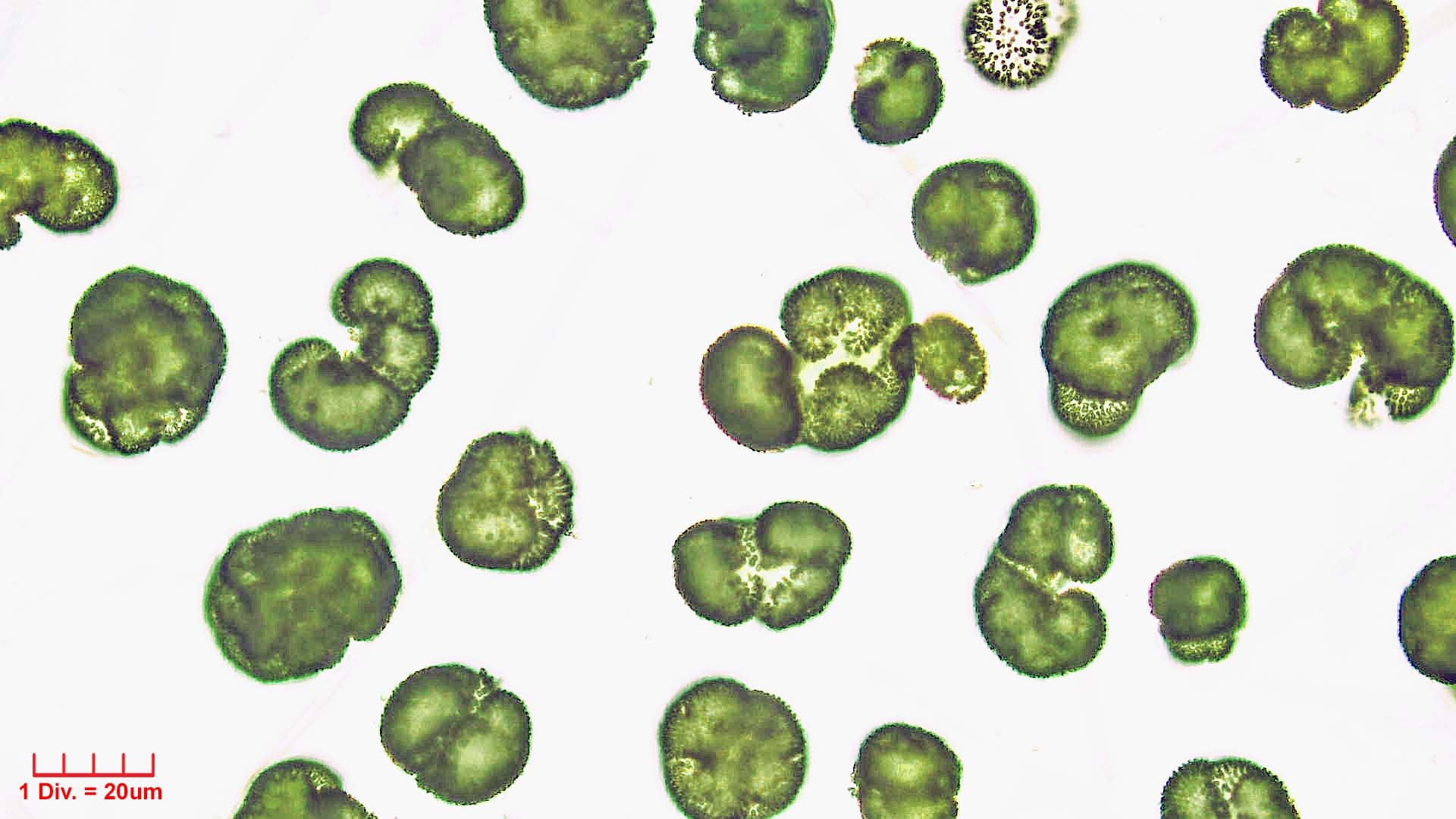 ./Cyanobacteria/Synechococcales/Coleosphaeriaceae/Woronichinia/naegeliana/woronichinia-naegeliana-105.jpg