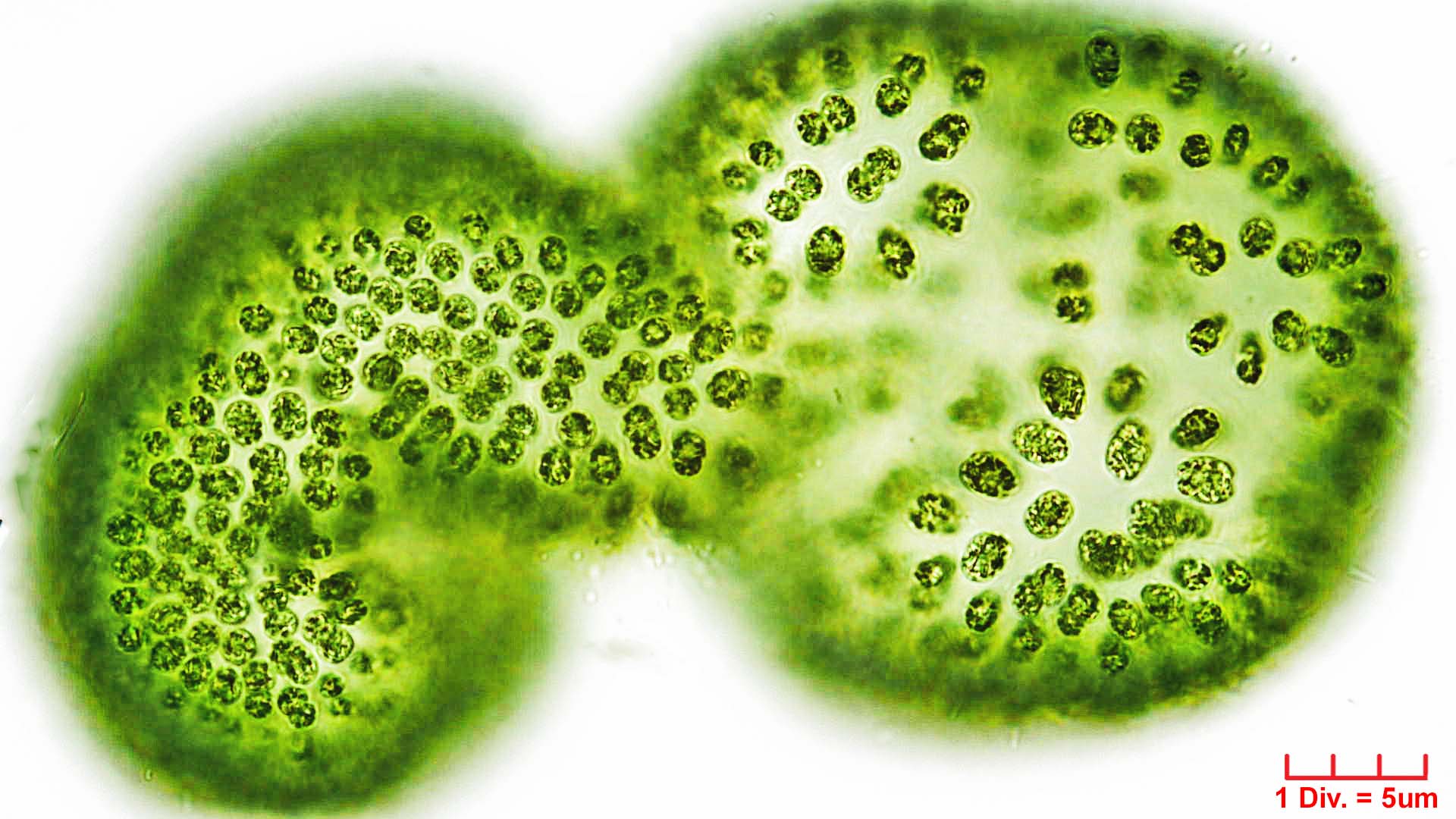 ./Cyanobacteria/Synechococcales/Coleosphaeriaceae/Woronichinia/naegeliana/woronichinia-naegeliana-106.jpg