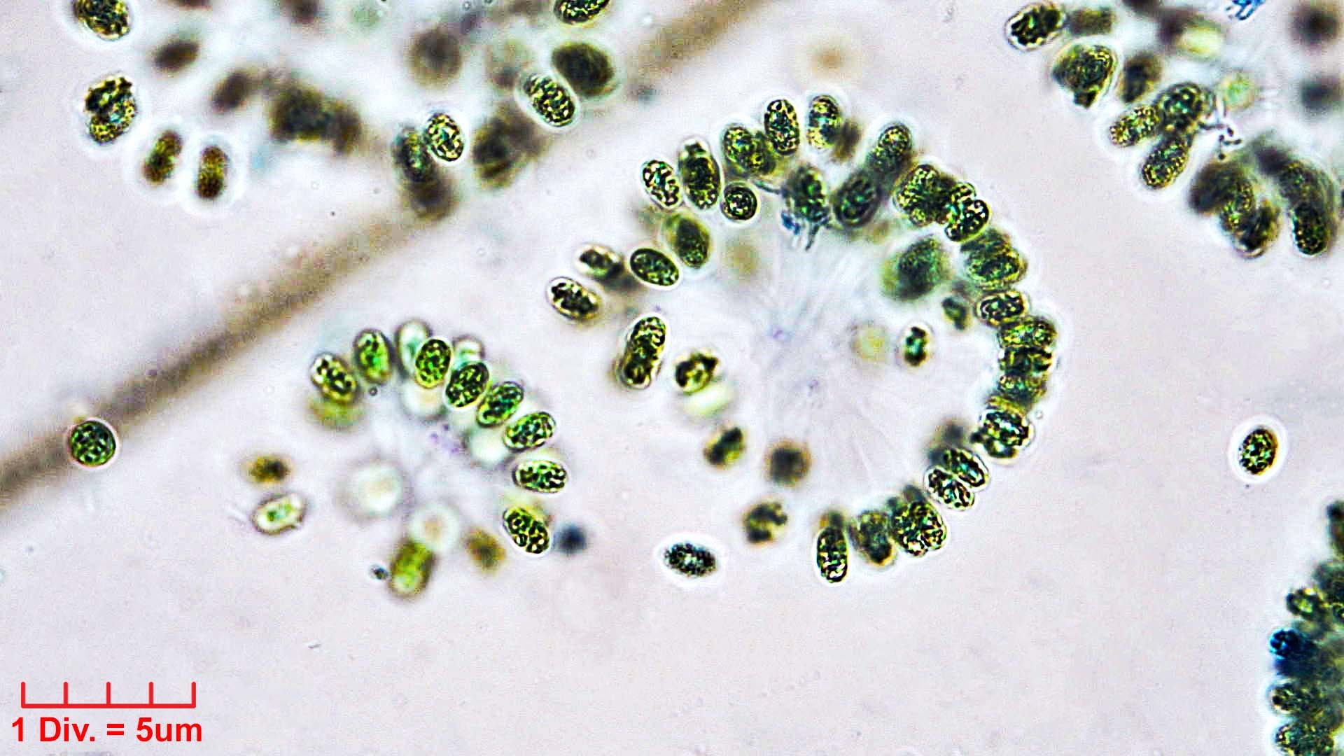 ./Cyanobacteria/Synechococcales/Coleosphaeriaceae/Woronichinia/naegeliana/woronichinia-naegeliana-107.jpg