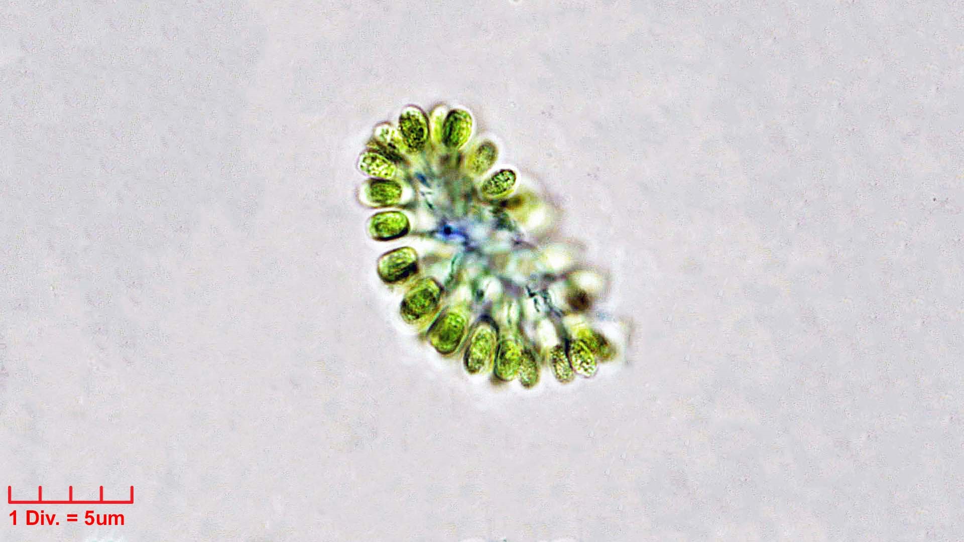 ./Cyanobacteria/Synechococcales/Coleosphaeriaceae/Woronichinia/naegeliana/woronichinia-naegeliana-108.jpg
