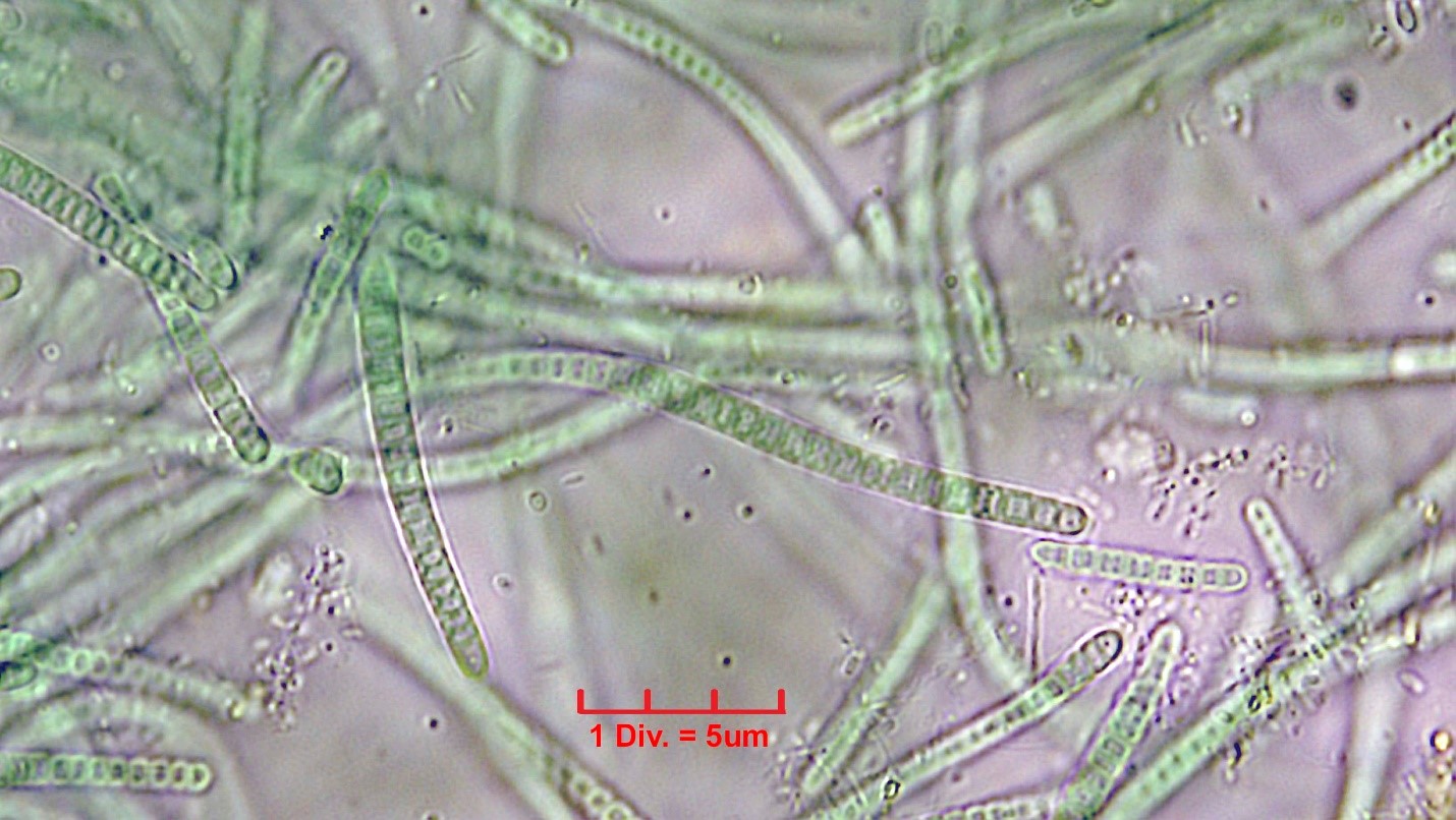 ././Cyanobacteria/Synechococcales/Leptolyngbyaceae/Leptolyngbya/foveolarum_cf/leptolyngbya-foveolarum-121.jpg