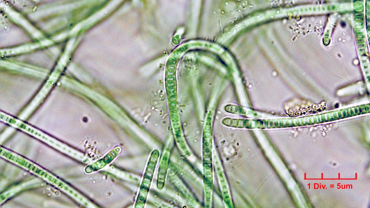 ././Cyanobacteria/Synechococcales/Leptolyngbyaceae/Leptolyngbya/foveolarum_cf/leptolyngbya-foveolarum-122.jpg