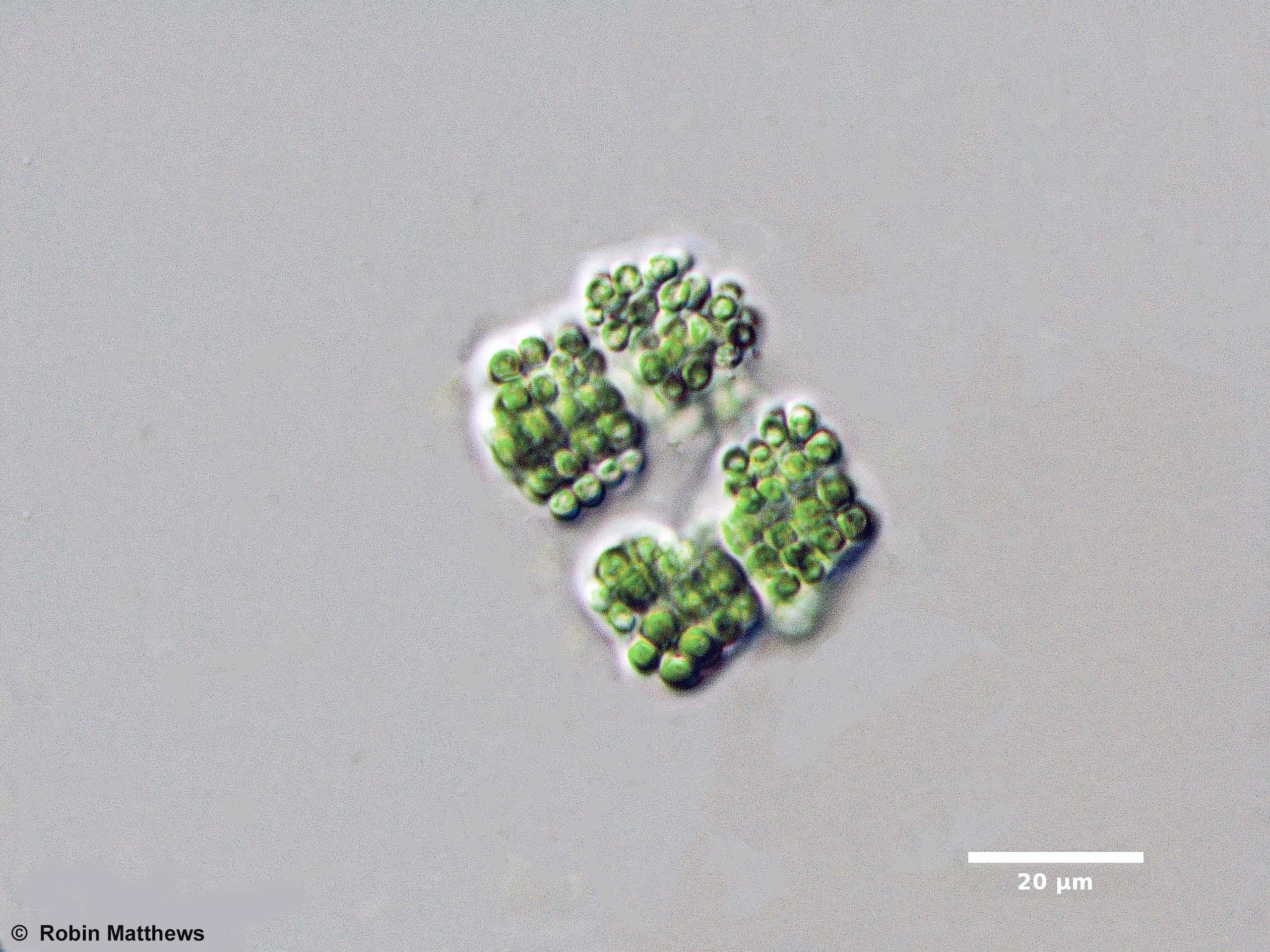 ././Cyanobacteria/Synechococcales/Merismopediaceae/Eucapsis/minor/eucapsis-minor-115.jpg