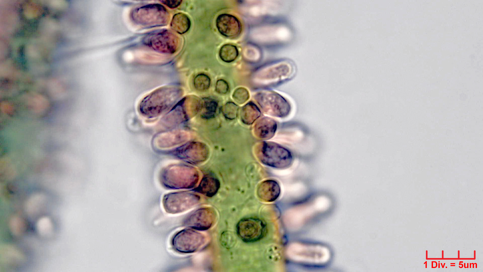 ././Cyanobacteria/Synechococcales/Merismopediaceae/Microcrocis/geminata/microcrocis-geminata-2.jpg